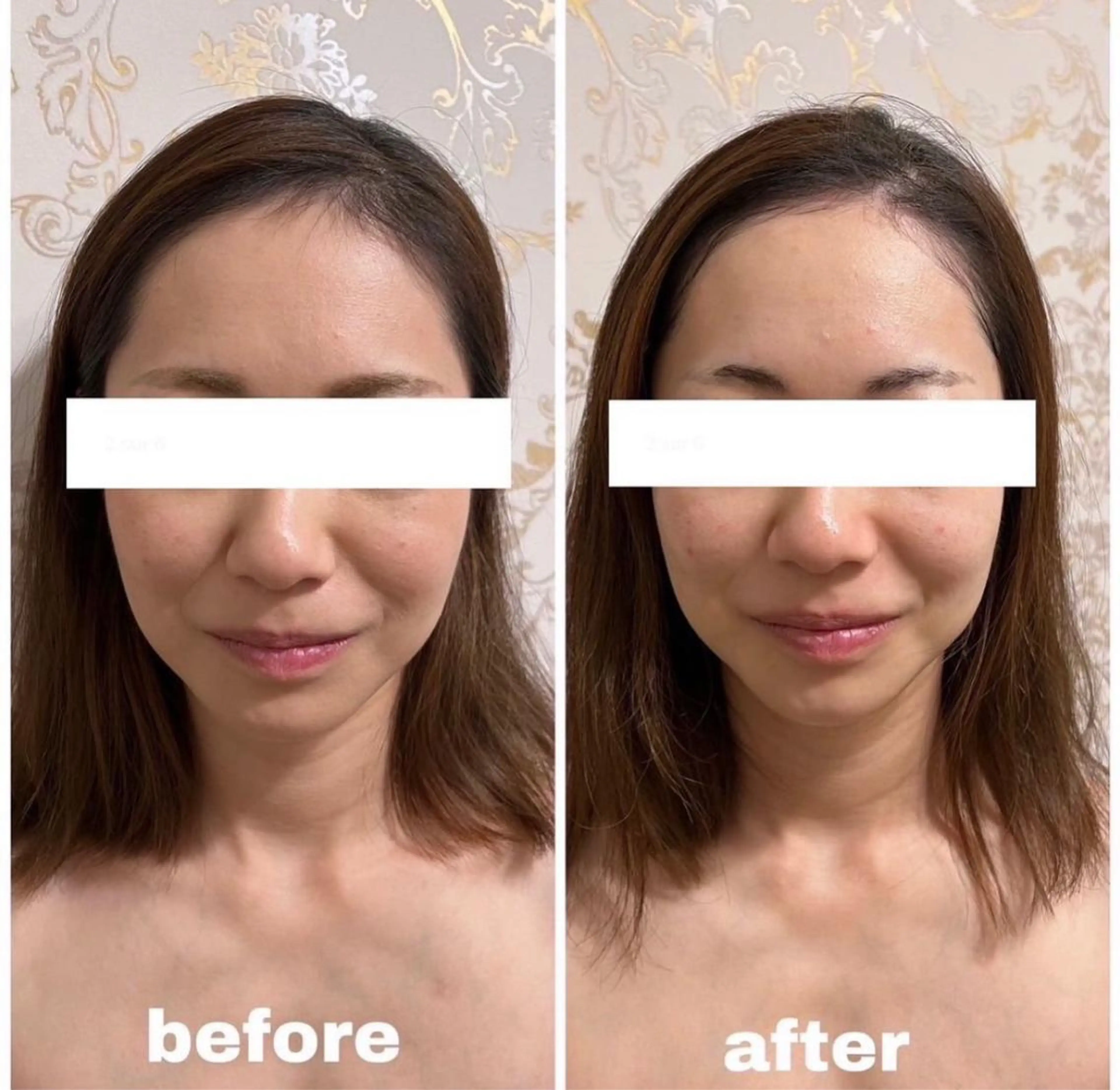 西区九条エステ MITUREIサロンのエステ・リラクイメージ