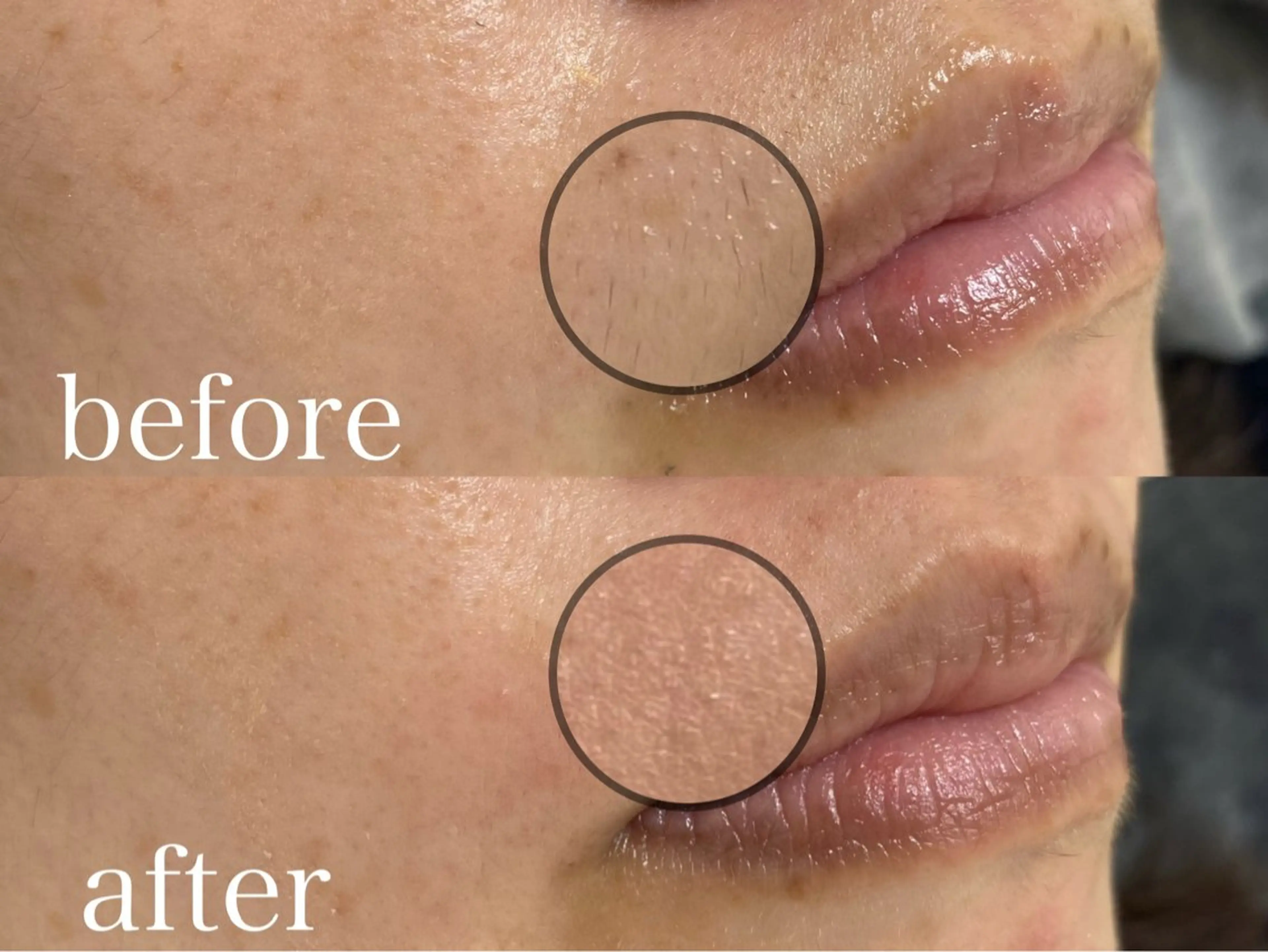 メンズ アイブロウ メンズパーマ ハリウッドブロウリフト 眉毛ワックス脱毛 Three スリーのマツエク・マツパデザイン