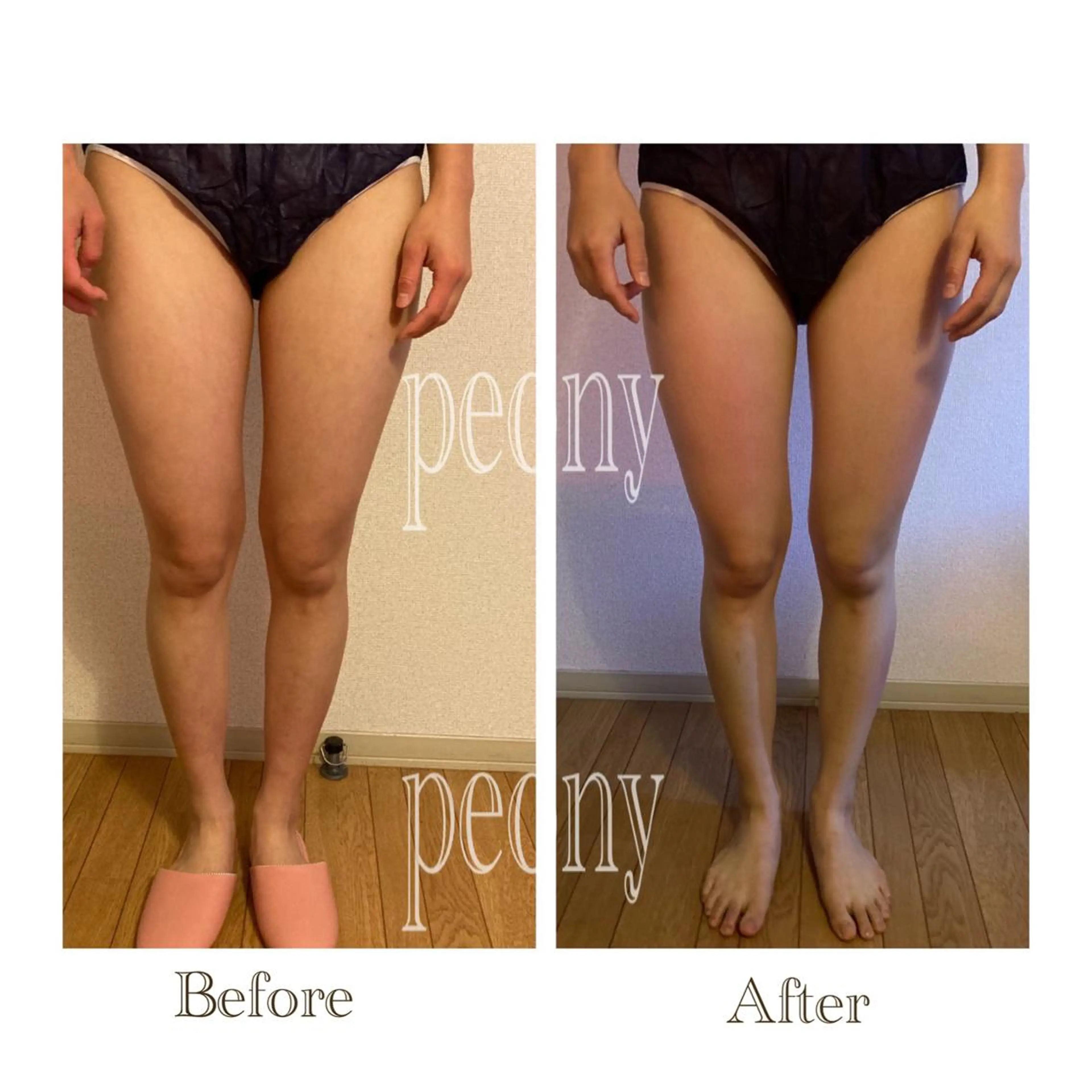 エステ デトックス美容専門サロンｐｅｏｎｙ所属・デトックス美容専門 サロンｐｅｏｎｙのエステ・リラクイメージ