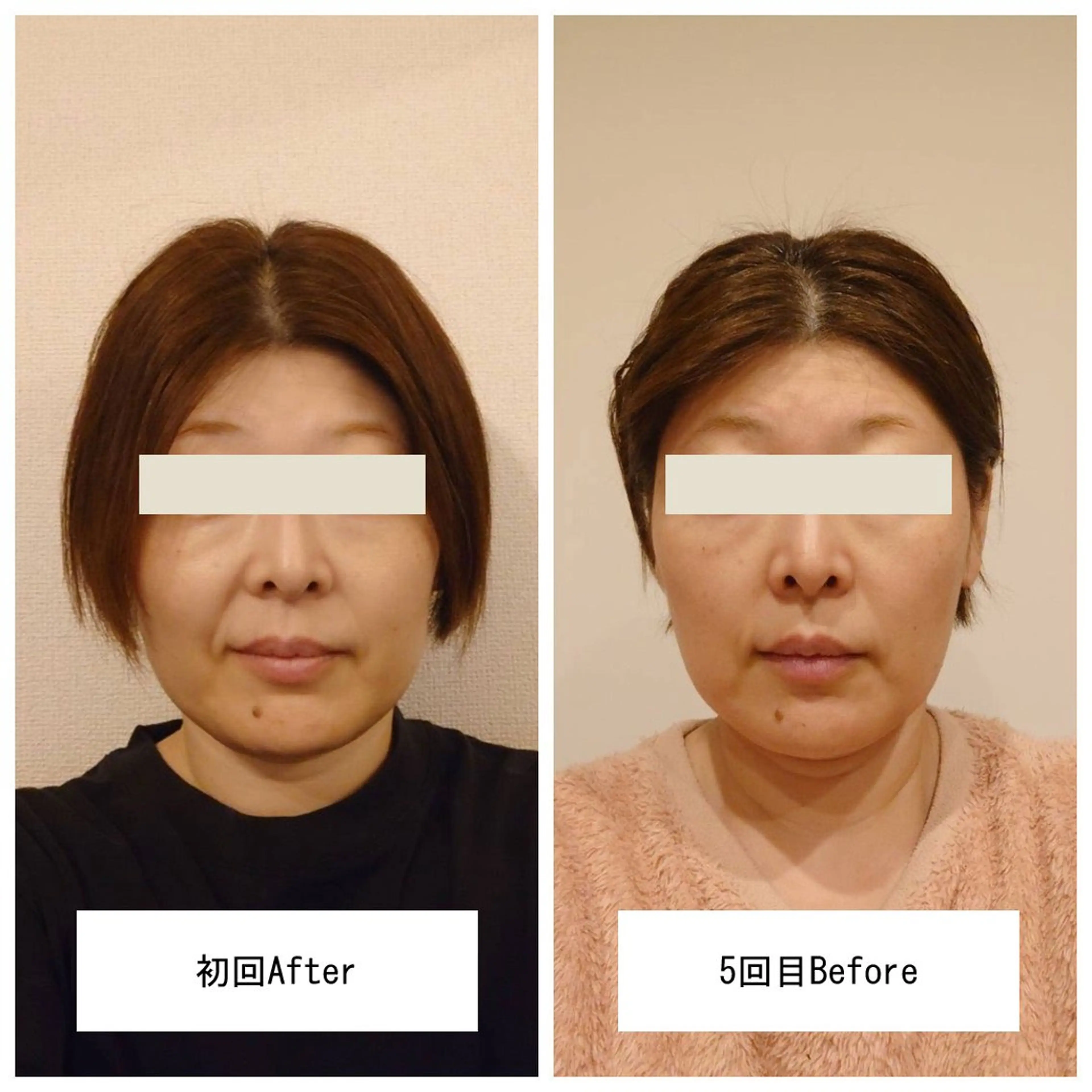 晴れ晴れ 整体院のエステ・リラクイメージ