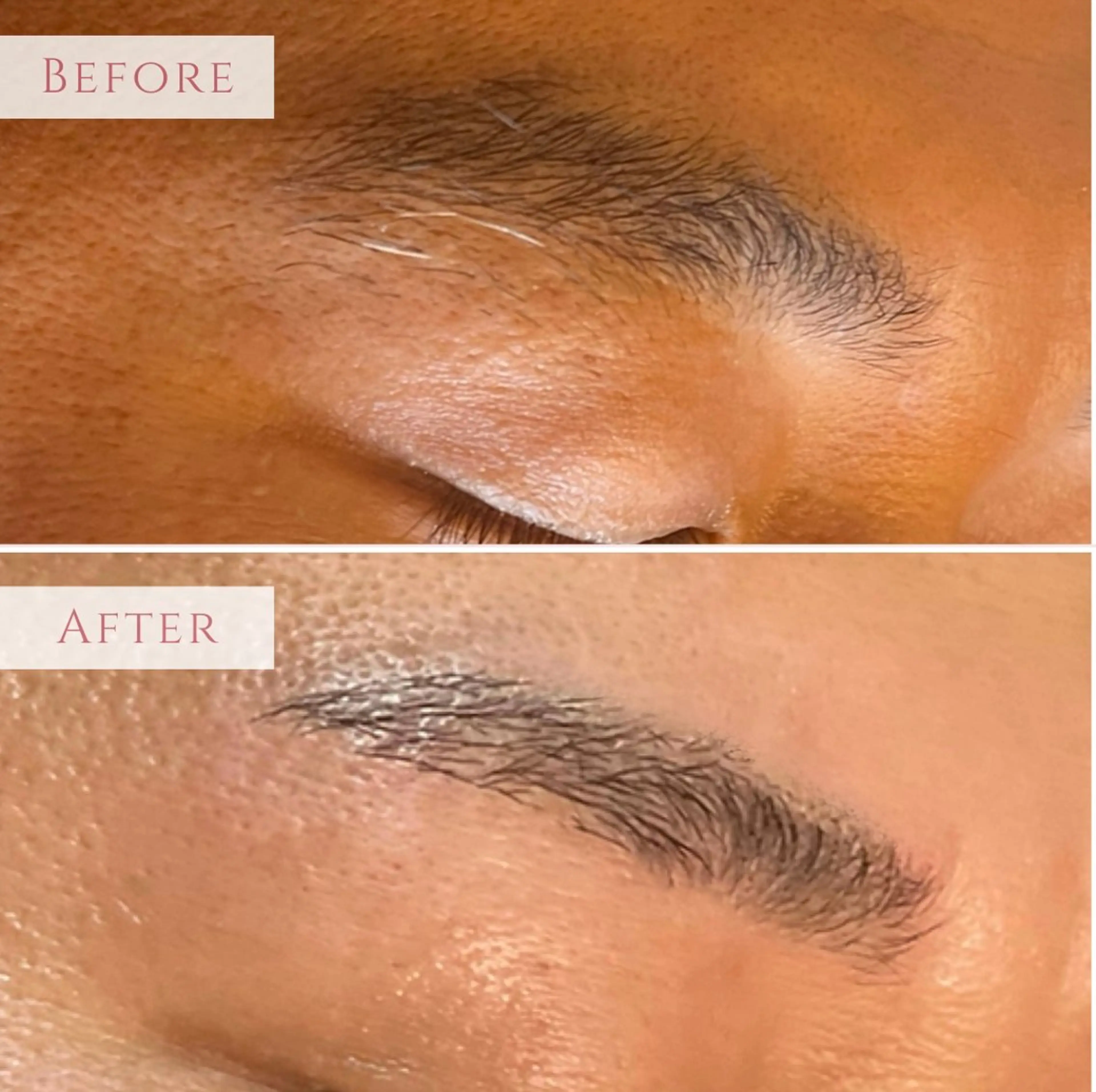 美眉毛デザインWax脱毛の写真