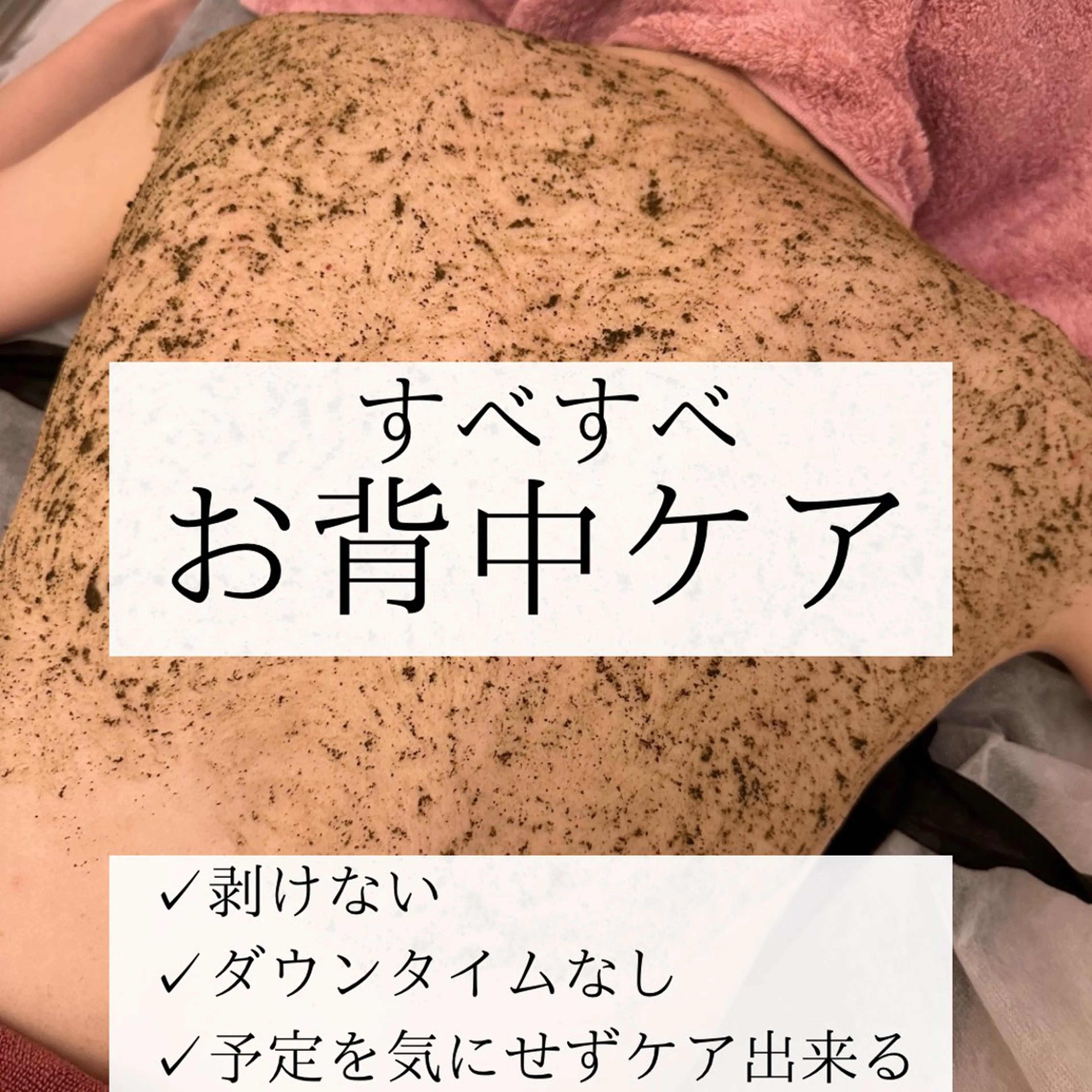 【ツヤツヤ背中】剥離なしハーブピーリング(背中上部or下部orお尻)ニキビ・黒ずみケア¥26400→21500の写真