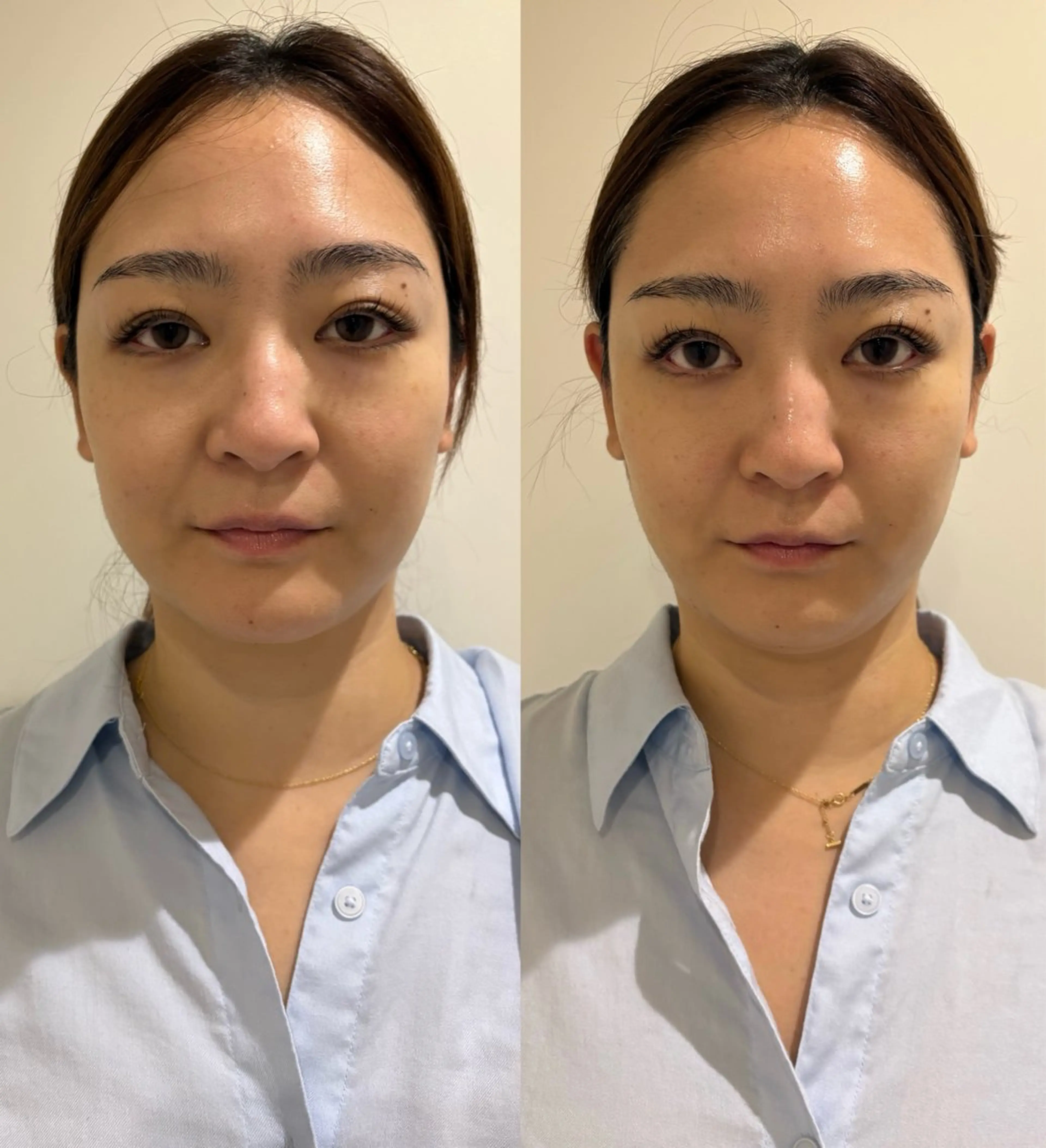 エステ リラク 美容鍼灸サロン mahoroba院長のエステ・リラクイメージ