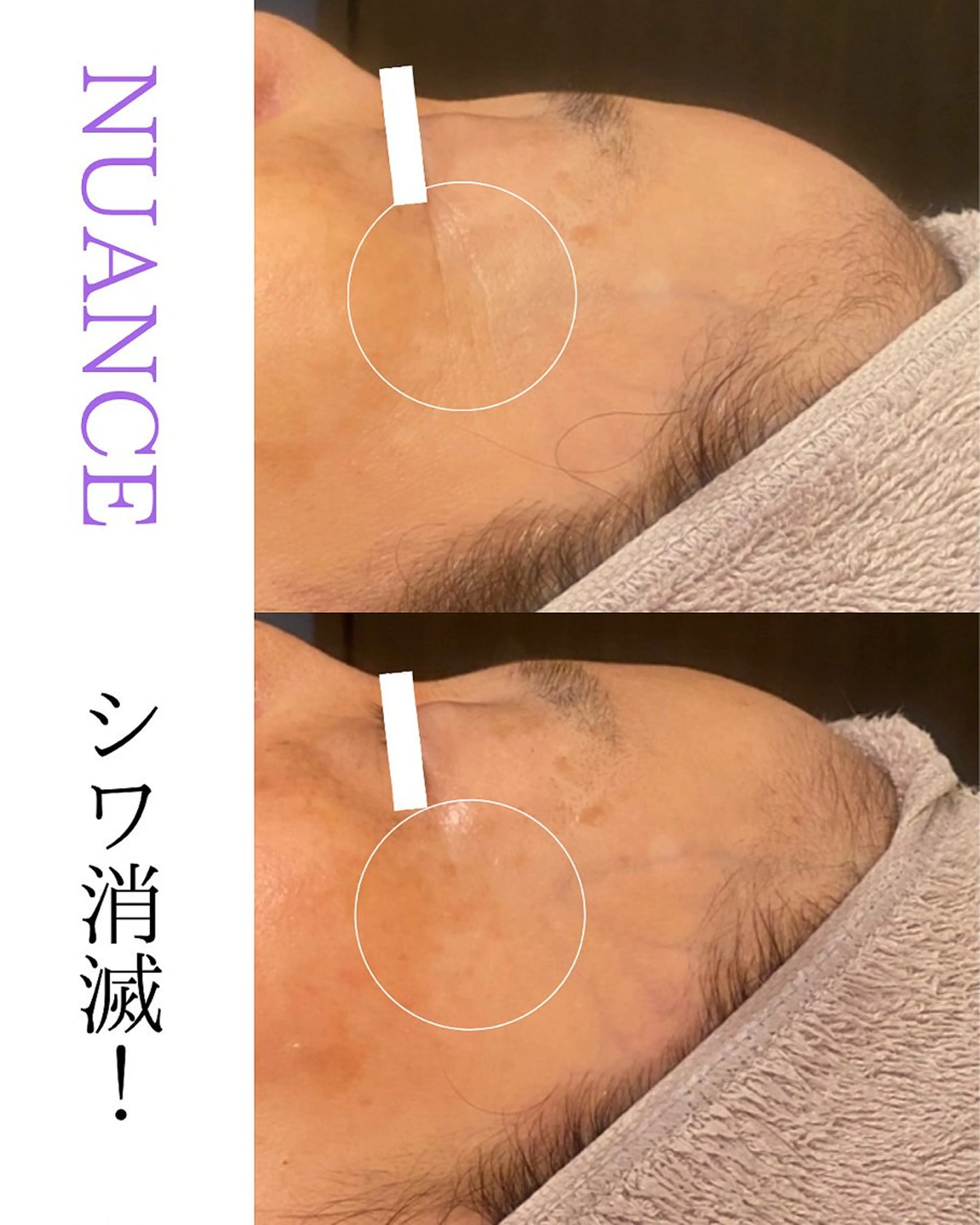 田中For..天王寺 肌質改善/よもぎ蒸しのエステ・リラクイメージ