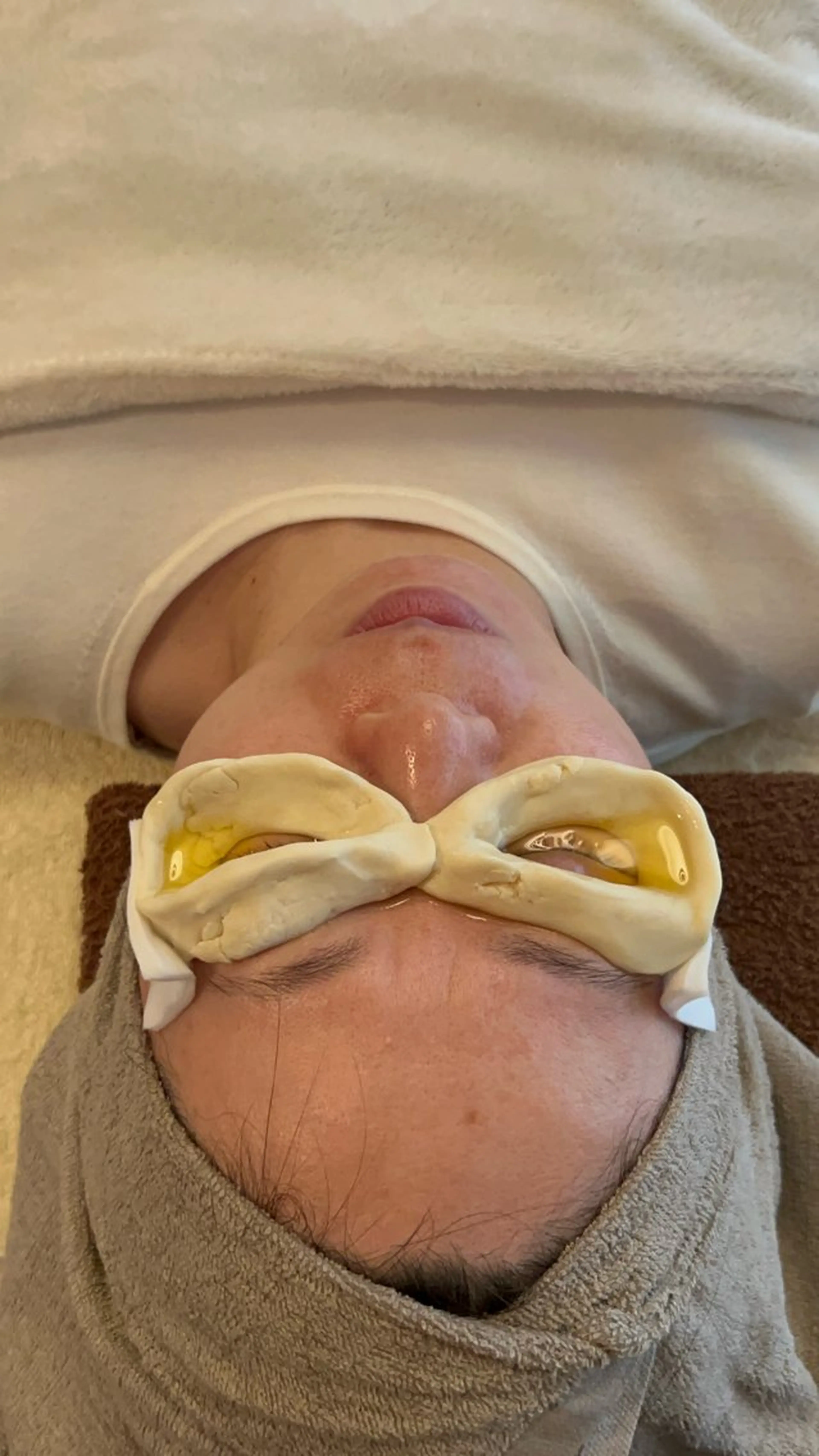 エステ リラク 鍼灸•マッサージサロンCalfa所属・《美肌･小顔》美容鍼 ＆マッサージ＊MEIのエステ・リラクイメージ