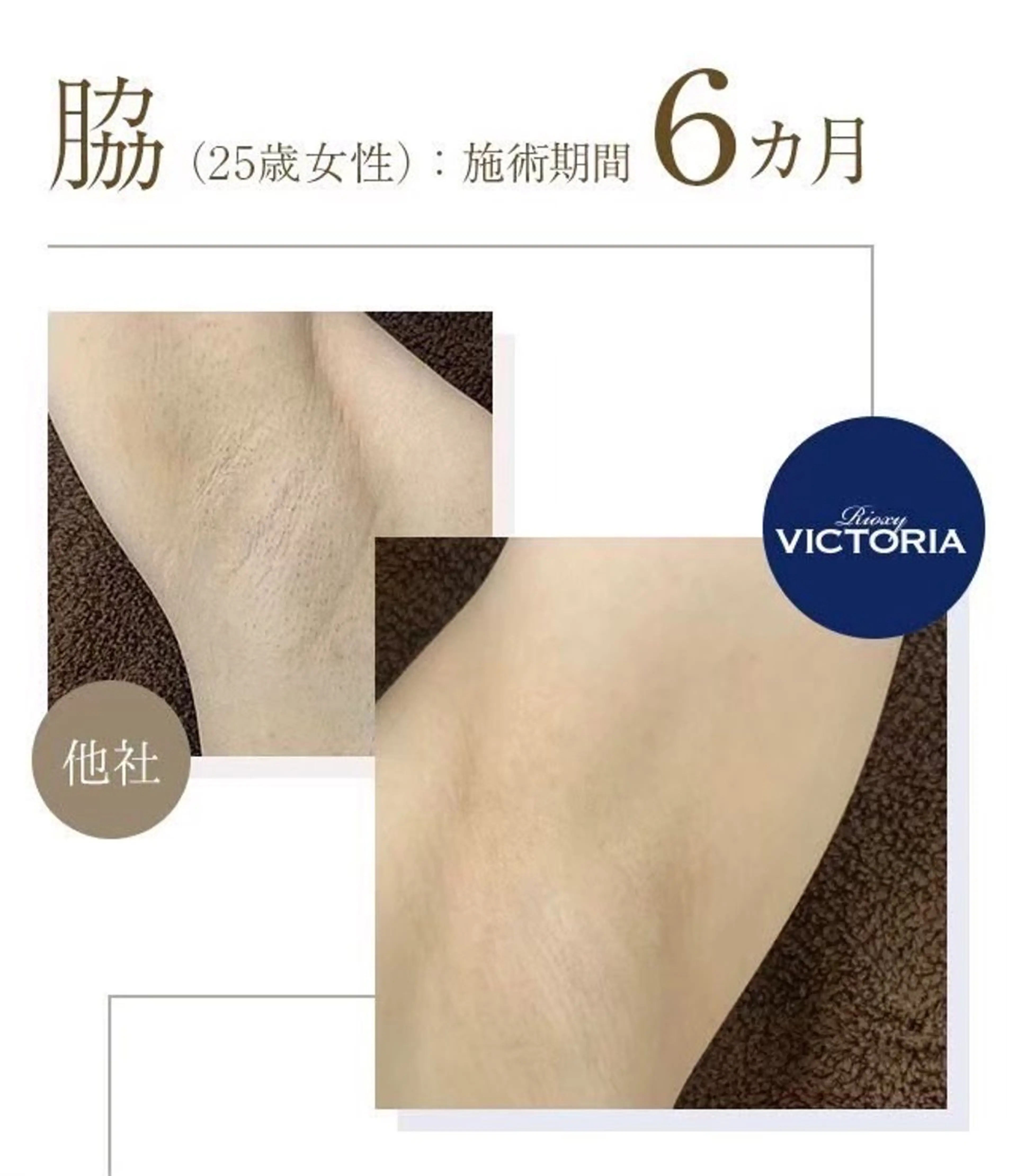 初回お試し選べる3部位　Sパーツの写真