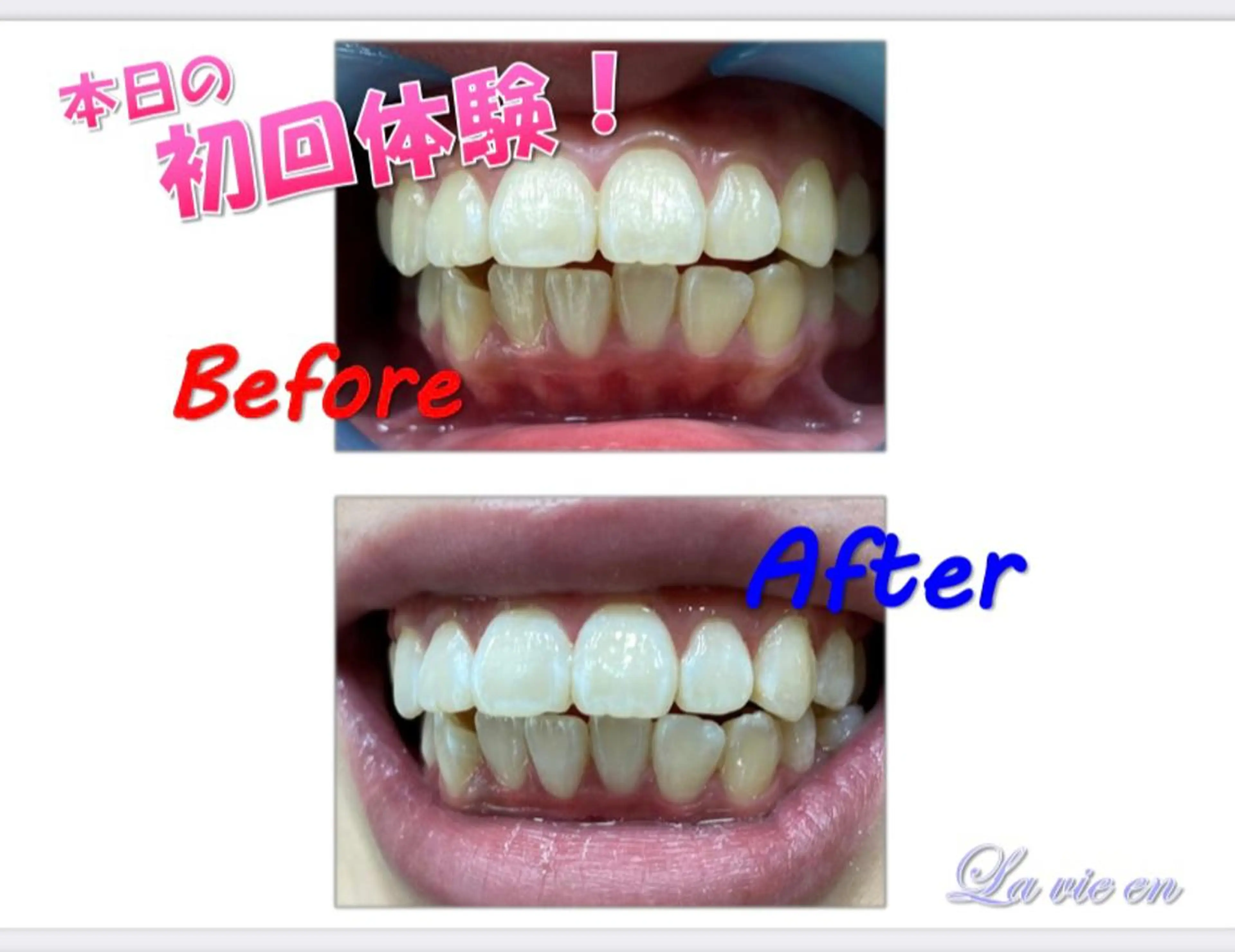 その他 セルフホワイトニングサロン　ラヴィアン所属・ホワイトニングサロン La vie enのその他イメージ