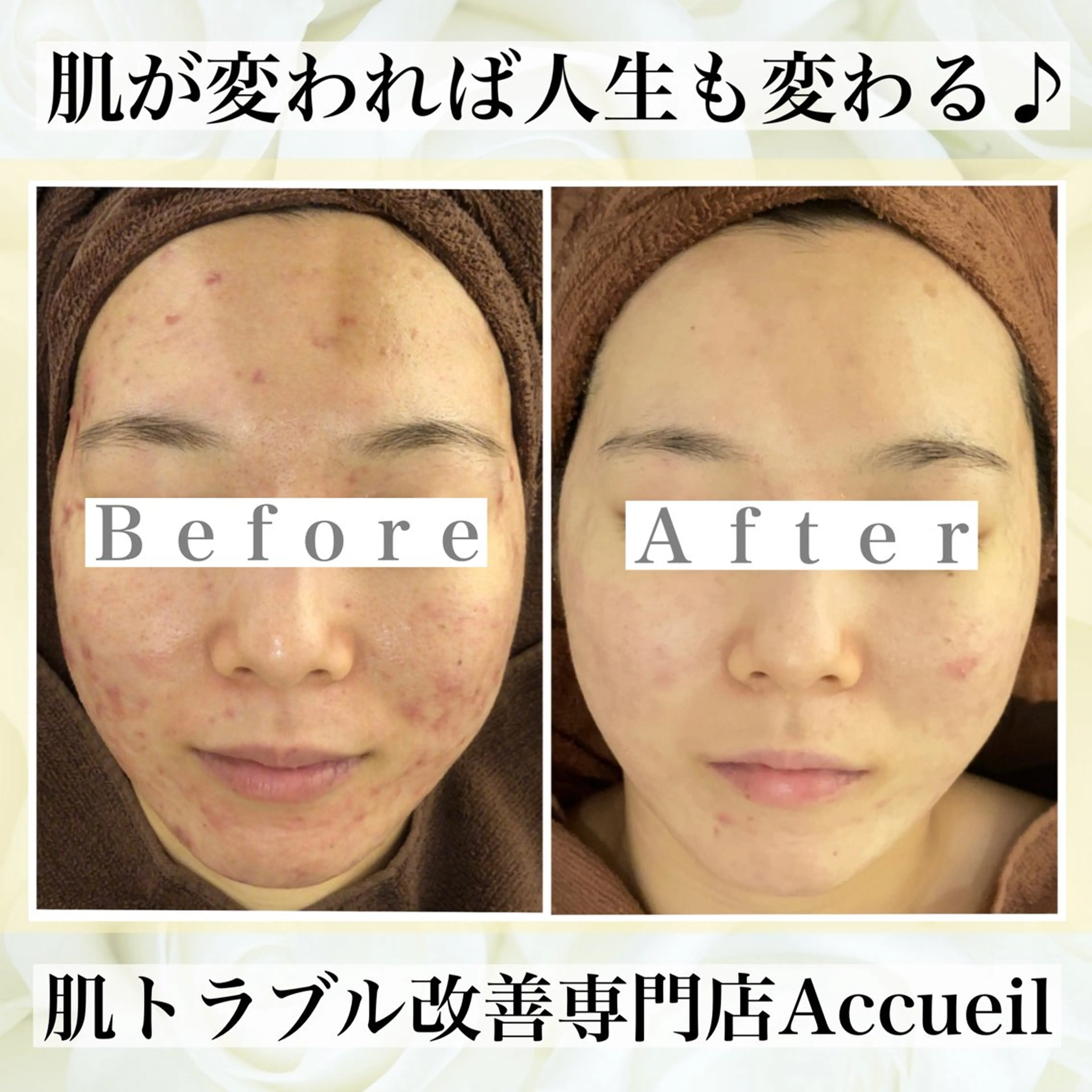 エステ リラク ニキビ・肌質改善専門 ♡人生が変わるサロンのエステ・リラクイメージ