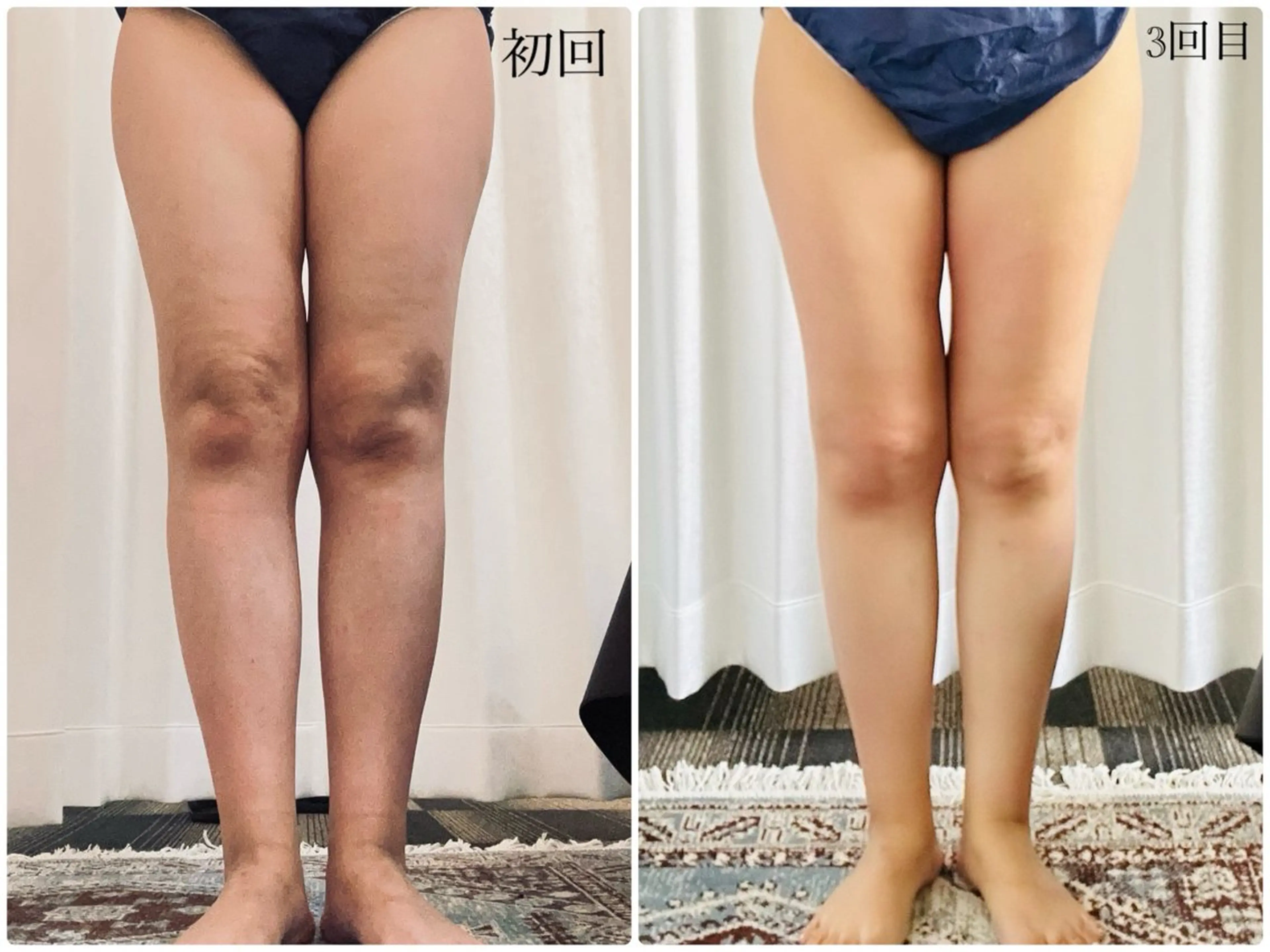 エステ tresor所属・tresor ビューティーサロンのエステ・リラクイメージ