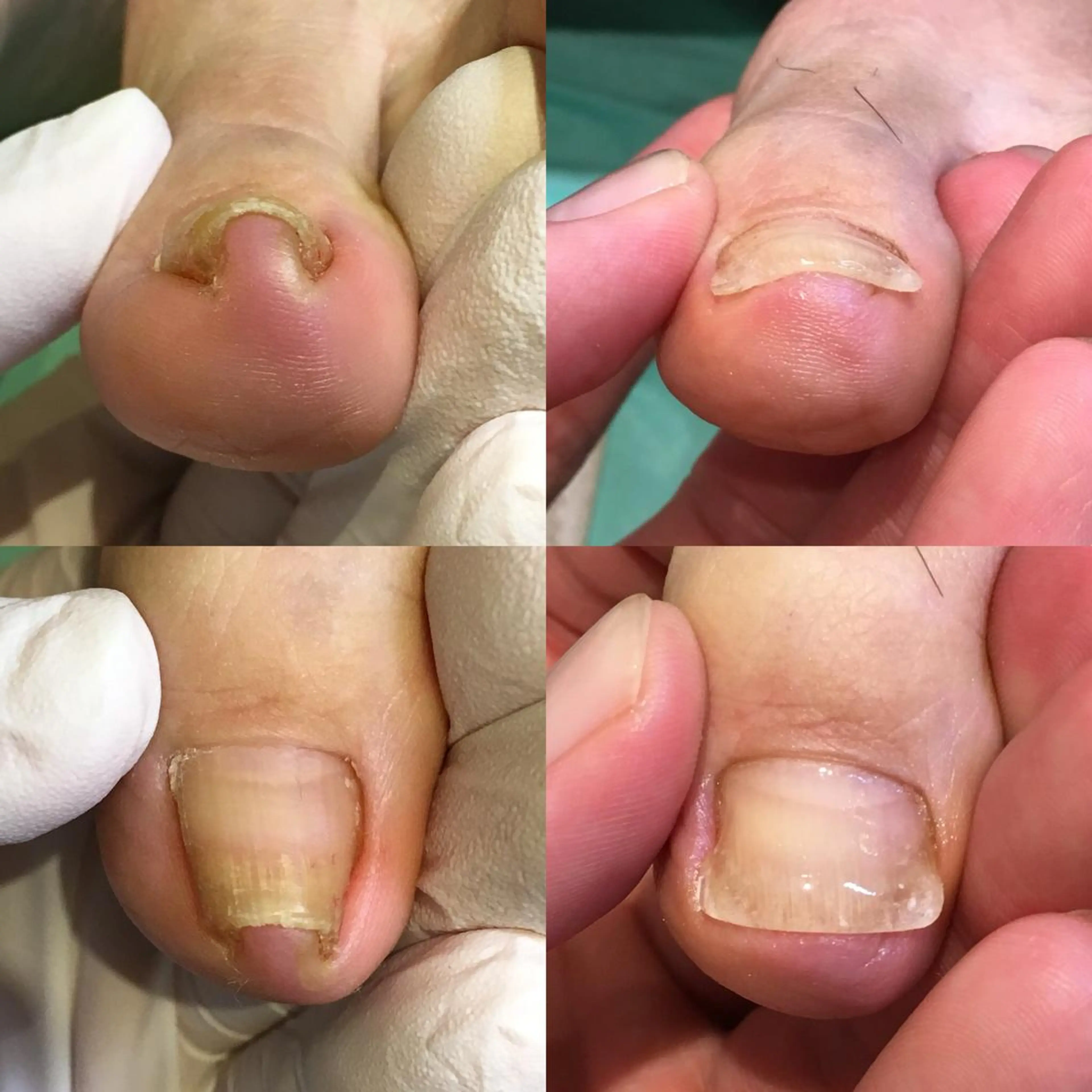 ネイル 東京巻き爪アカデミー所属・東京巻き爪 アカデミーのエステ・リラクイメージ