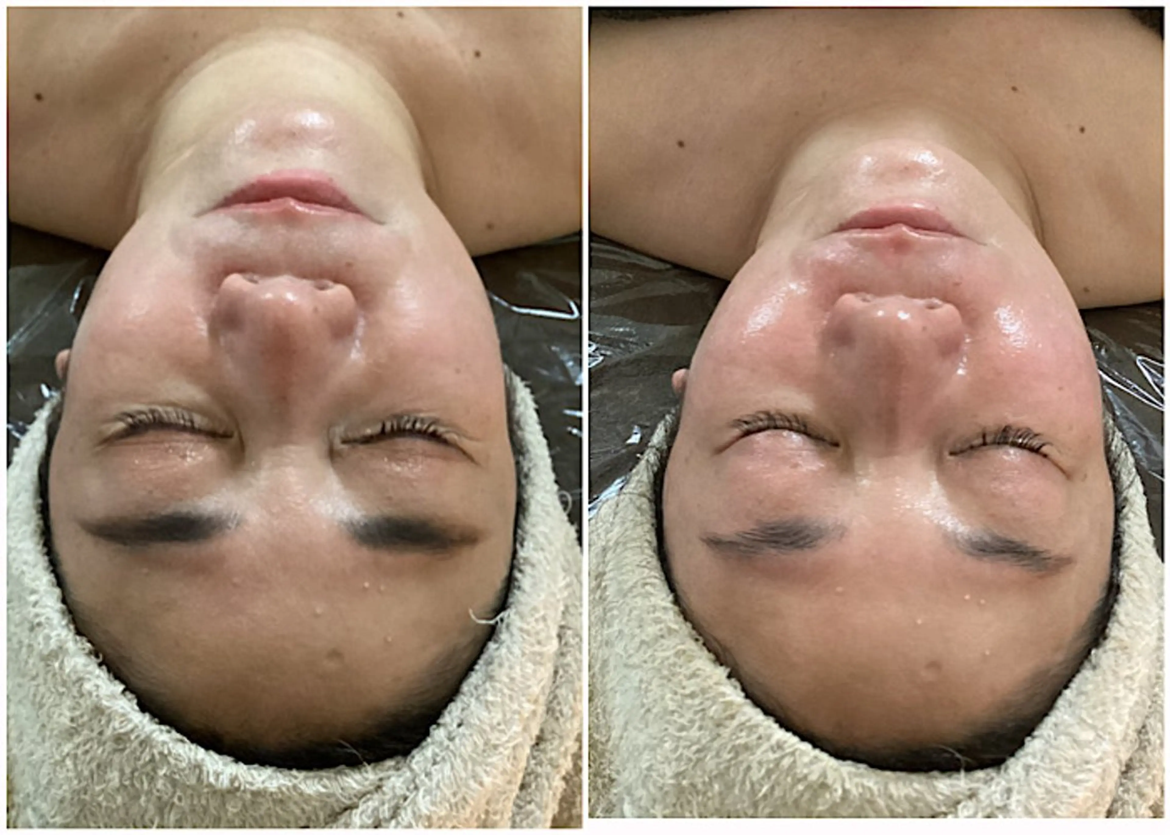 ize 横浜店のエステ・リラクイメージ