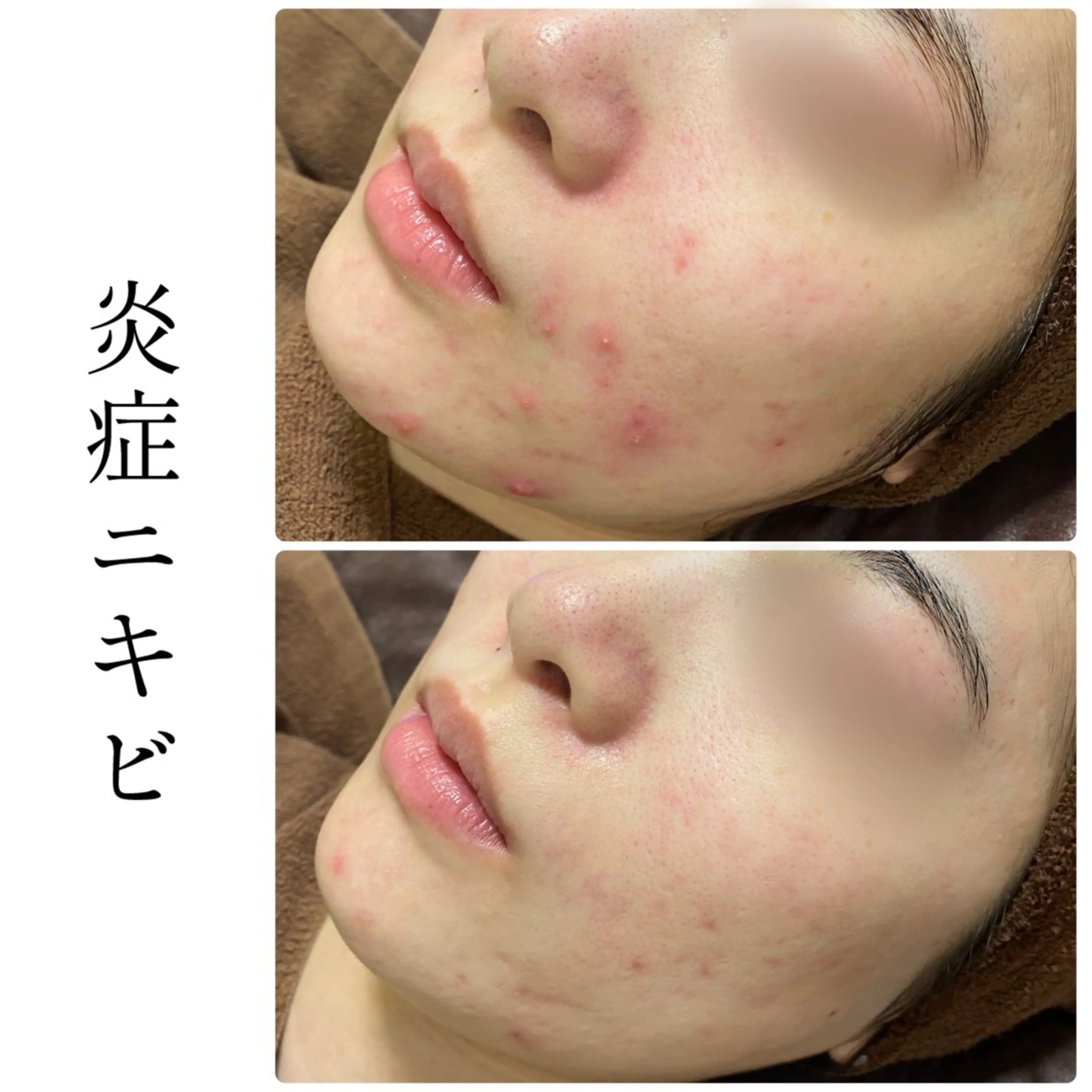 エステ ハーブピーリング専門 BIOEL横浜のエステ・リラクイメージ