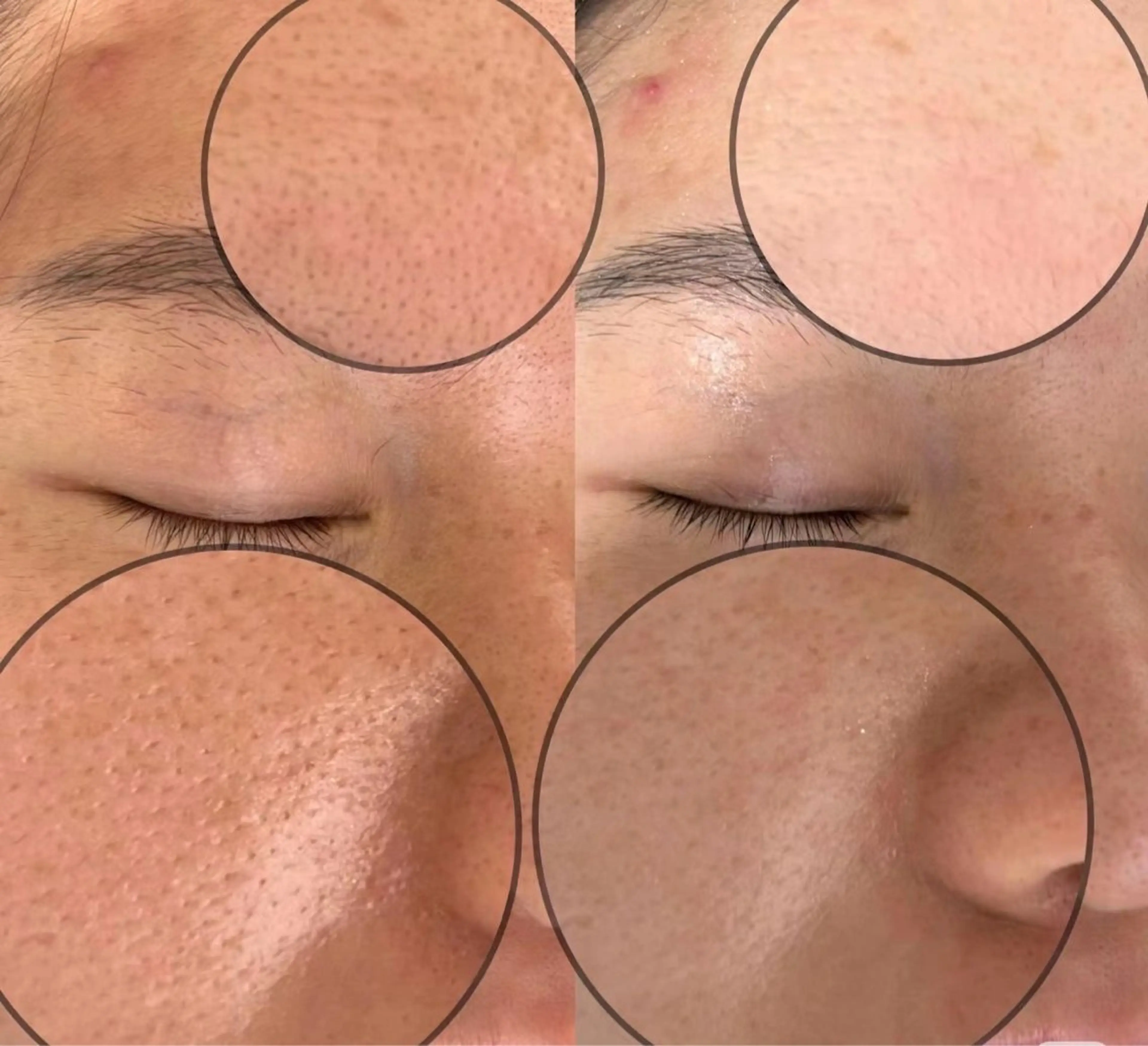 エステ リラク 愛維美水光美肌専門店所属・愛維美水光美肌専門店 メンズレディースokのエステ・リラクイメージ