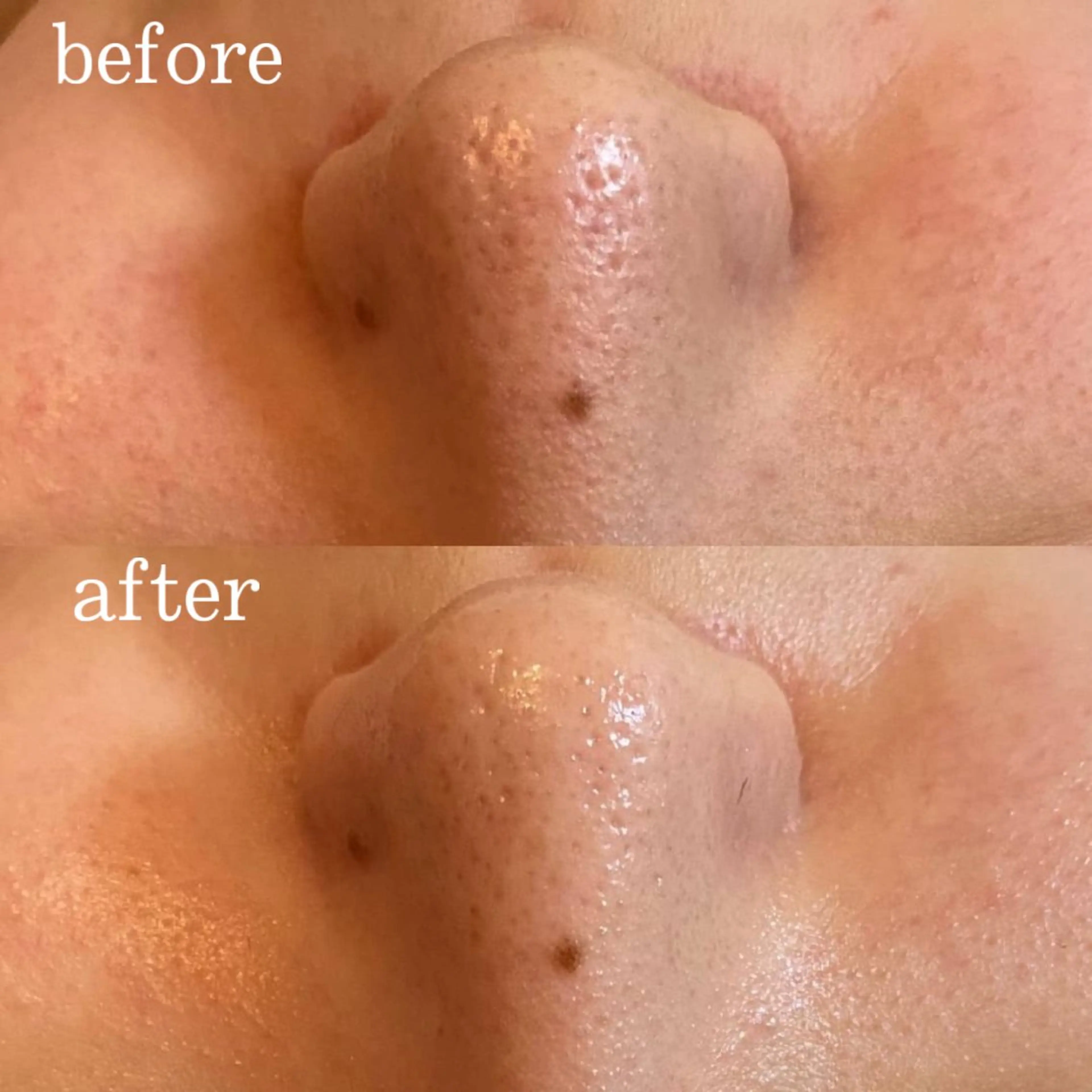 エステ DeI'm 京橋所属・肌質改善サロン AMIのエステ・リラクイメージ