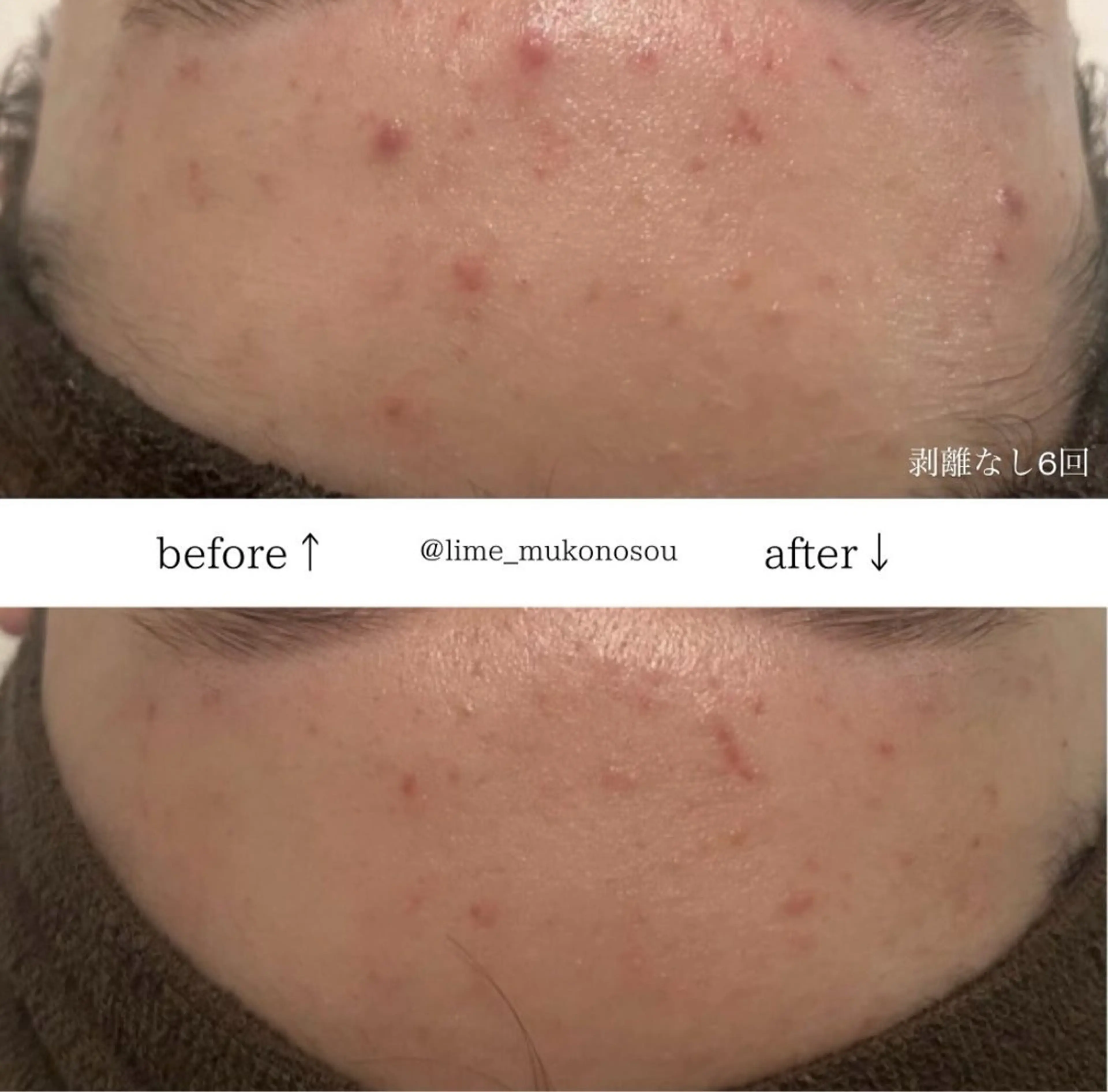 LIME武庫之荘所属・LIME 武庫之荘店のエステ・リラクイメージ