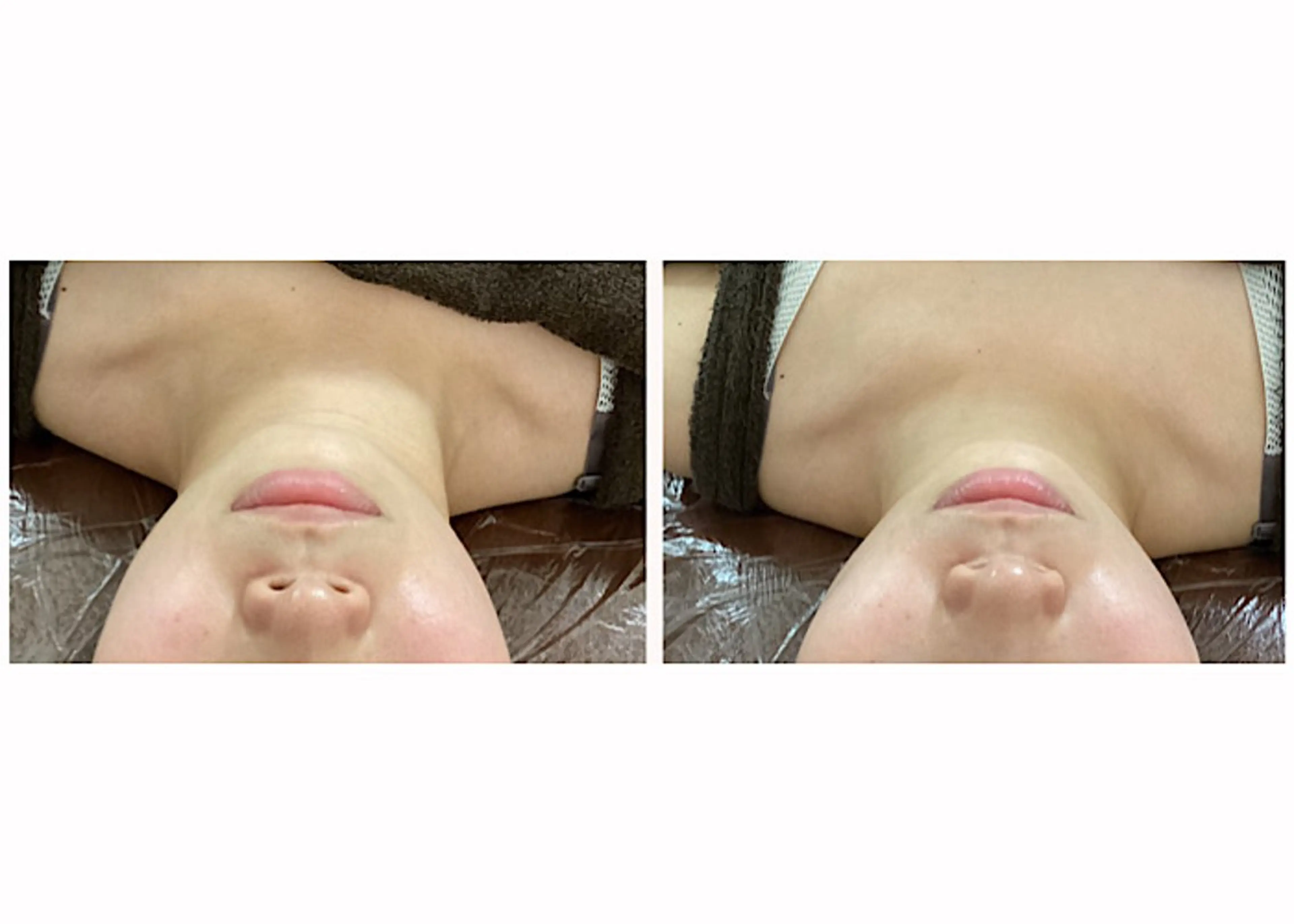 ize 横浜店のエステ・リラクイメージ