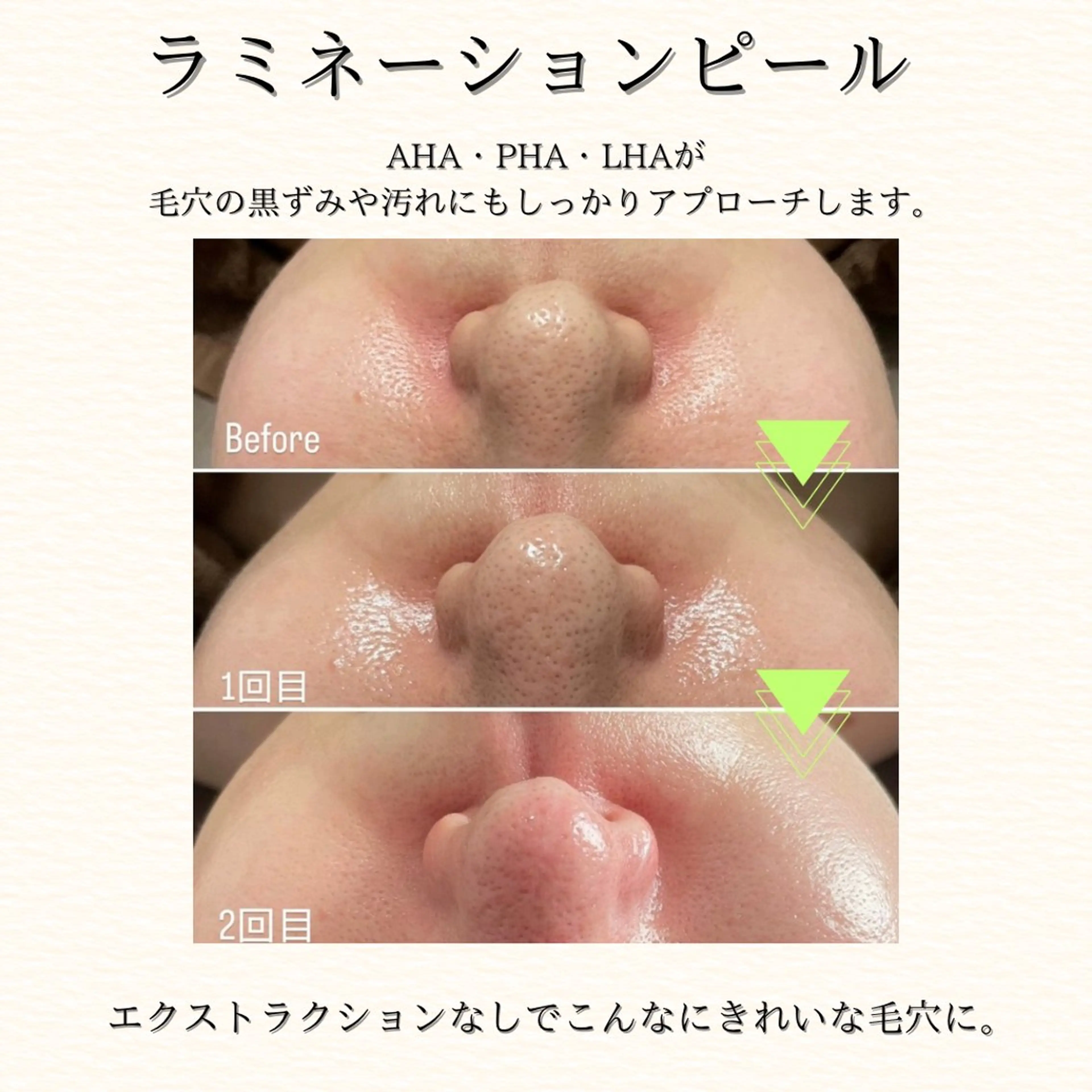 hue.所属・hue. YUKAのエステ・リラクイメージ