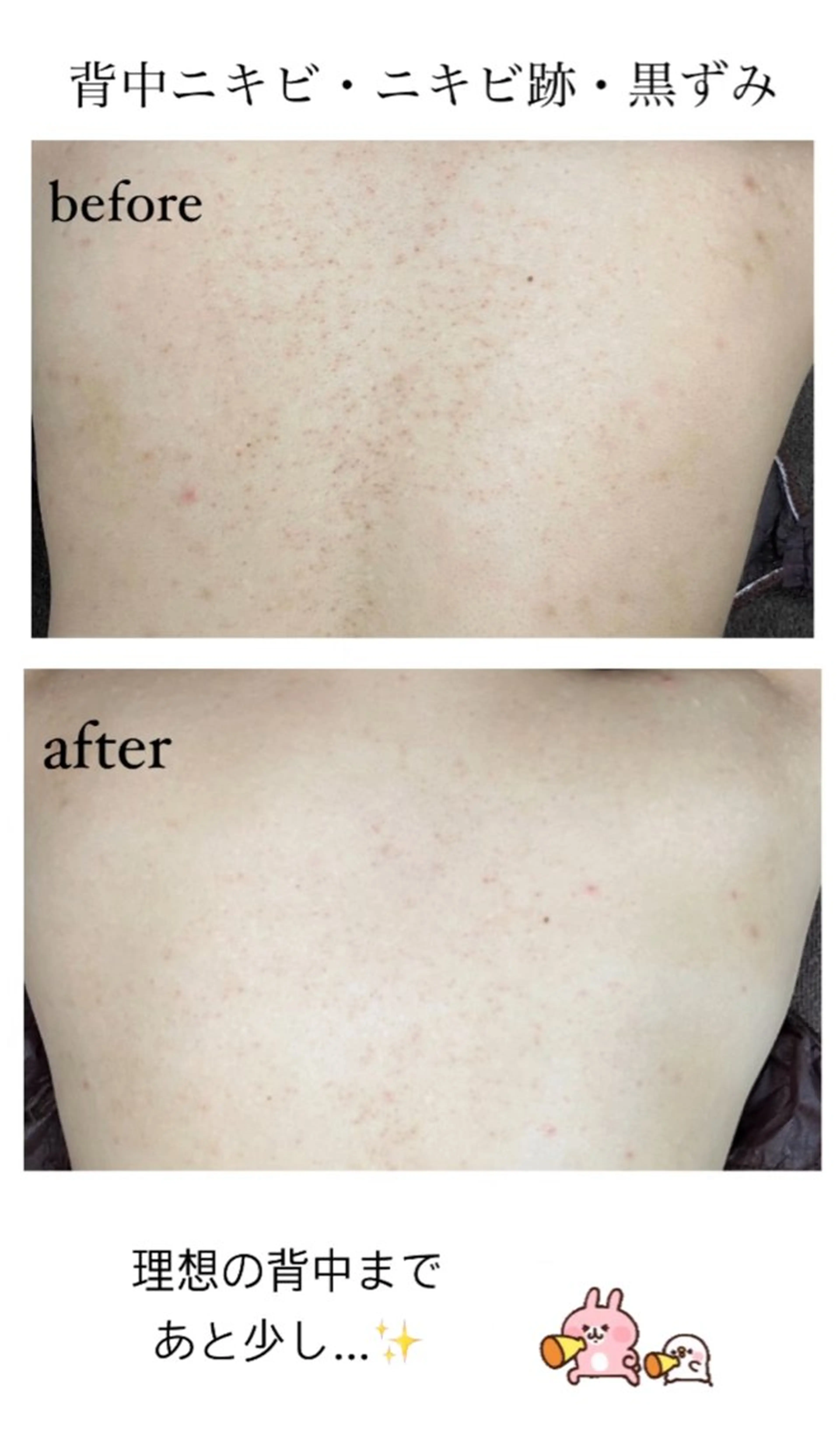 エステ ベラージュ【美背中・ 美尻・フェイシャル】のエステ・リラクイメージ