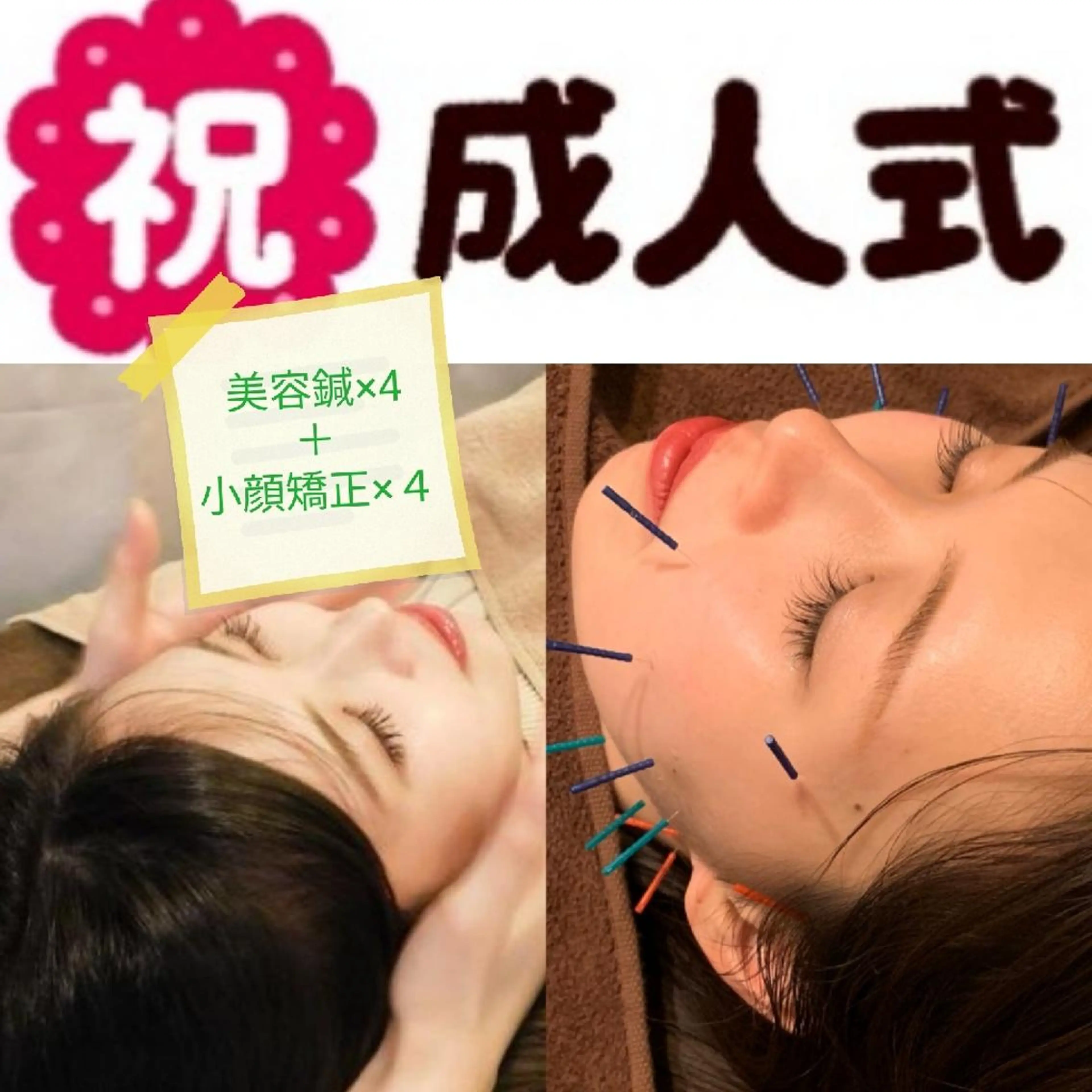 たるみ専門美容鍼 × 猫背整体 のぐち所属・小顔と姿勢改善のプロ ｜整体と美容鍼のぐちのエステ・リラクイメージ