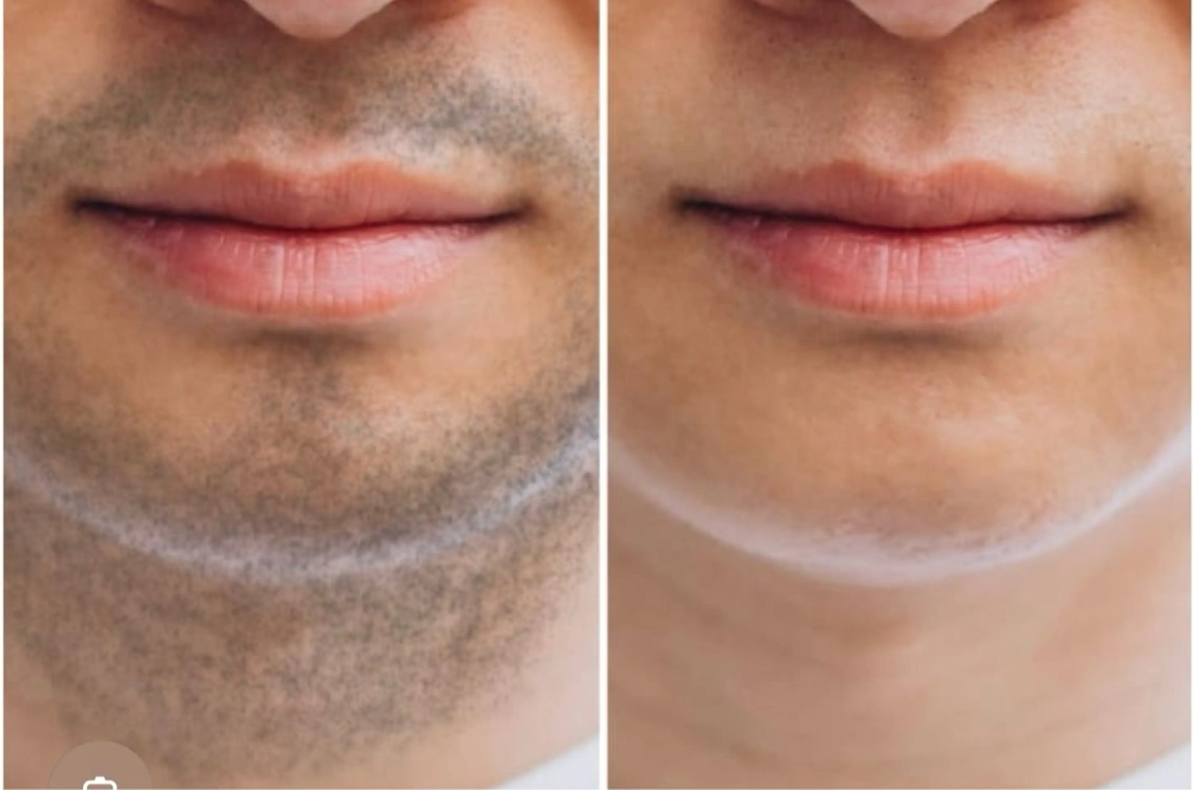 エステ Lala Beautyのエステ・リラクイメージ