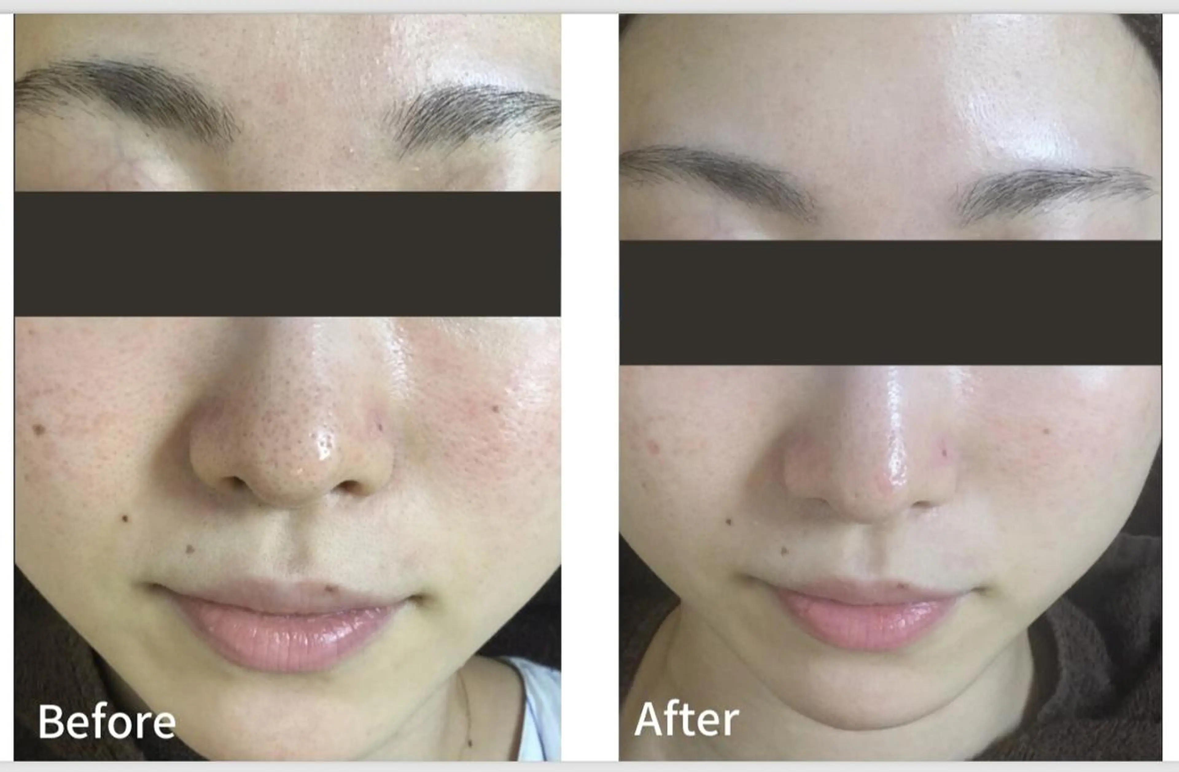 アンジェリック ビーナス　Rinonのエステ・リラクイメージ