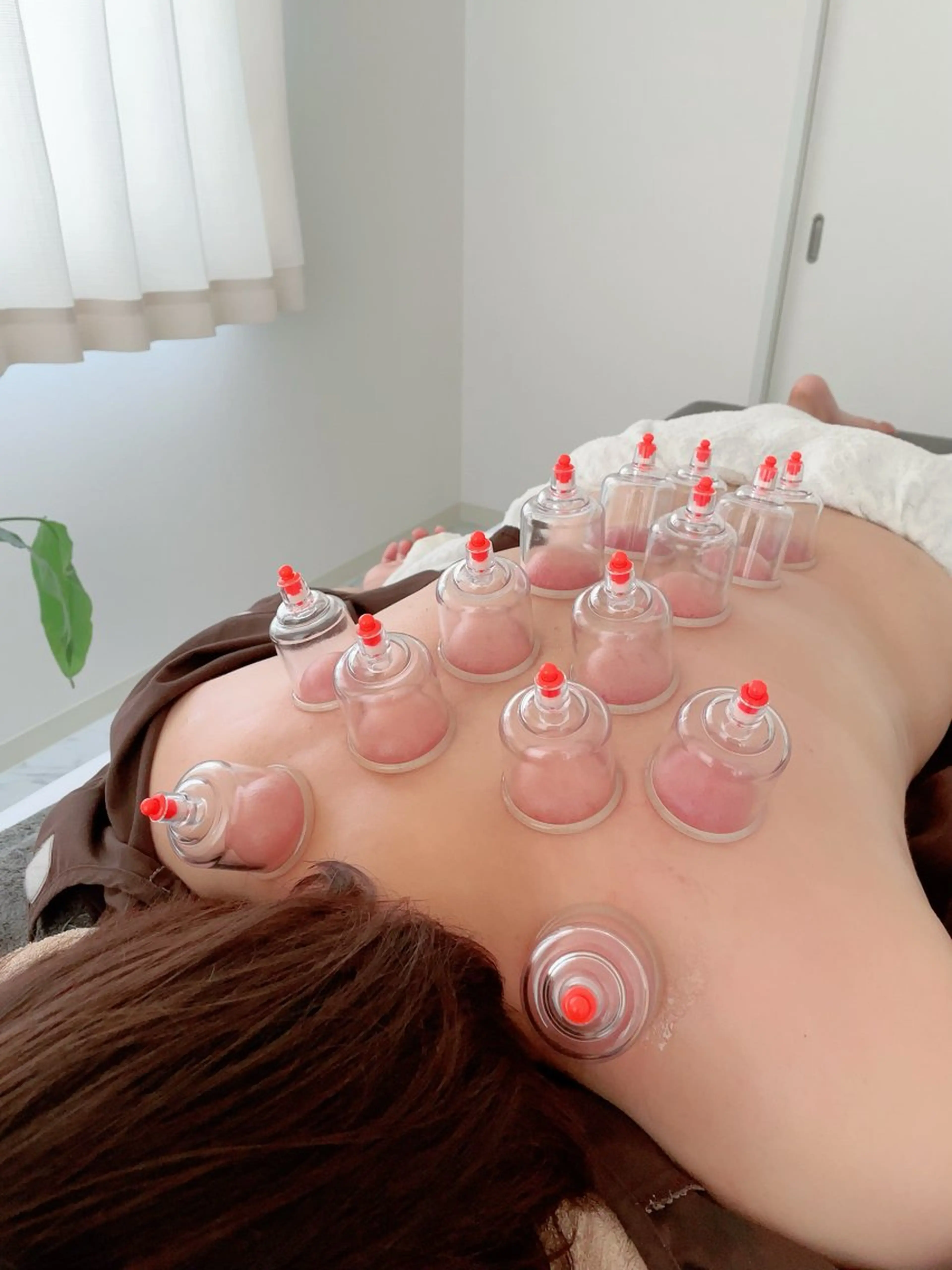 【大人気✨】吸い玉(カッピング)⭐️の写真