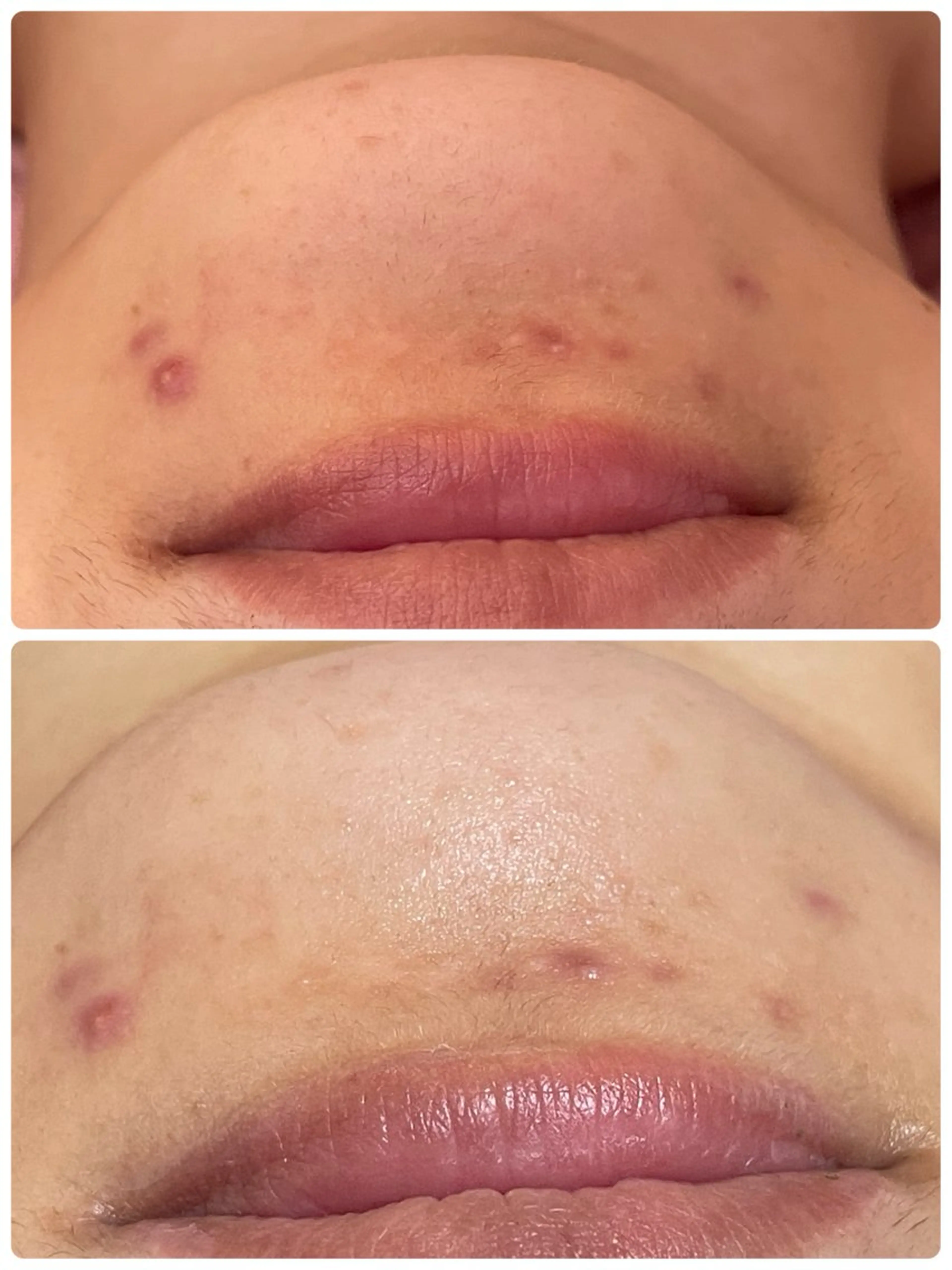 エステ 肌質改善専門店/絹々(きぬ)所属・心満たされる ハーブピーリング絹々のエステ・リラクイメージ