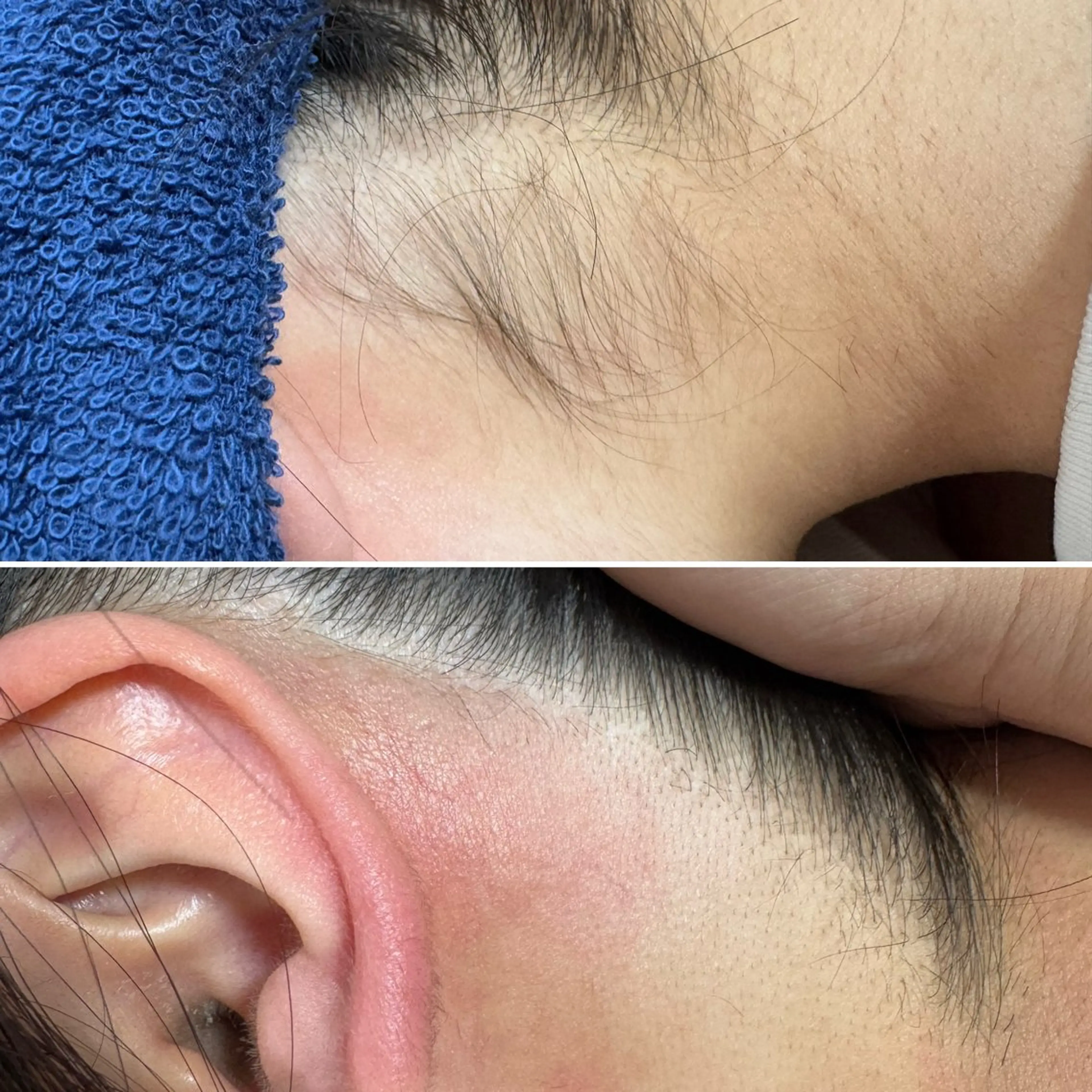 脱毛 Uruka関本 ふみ佳のエステ・リラクイメージ