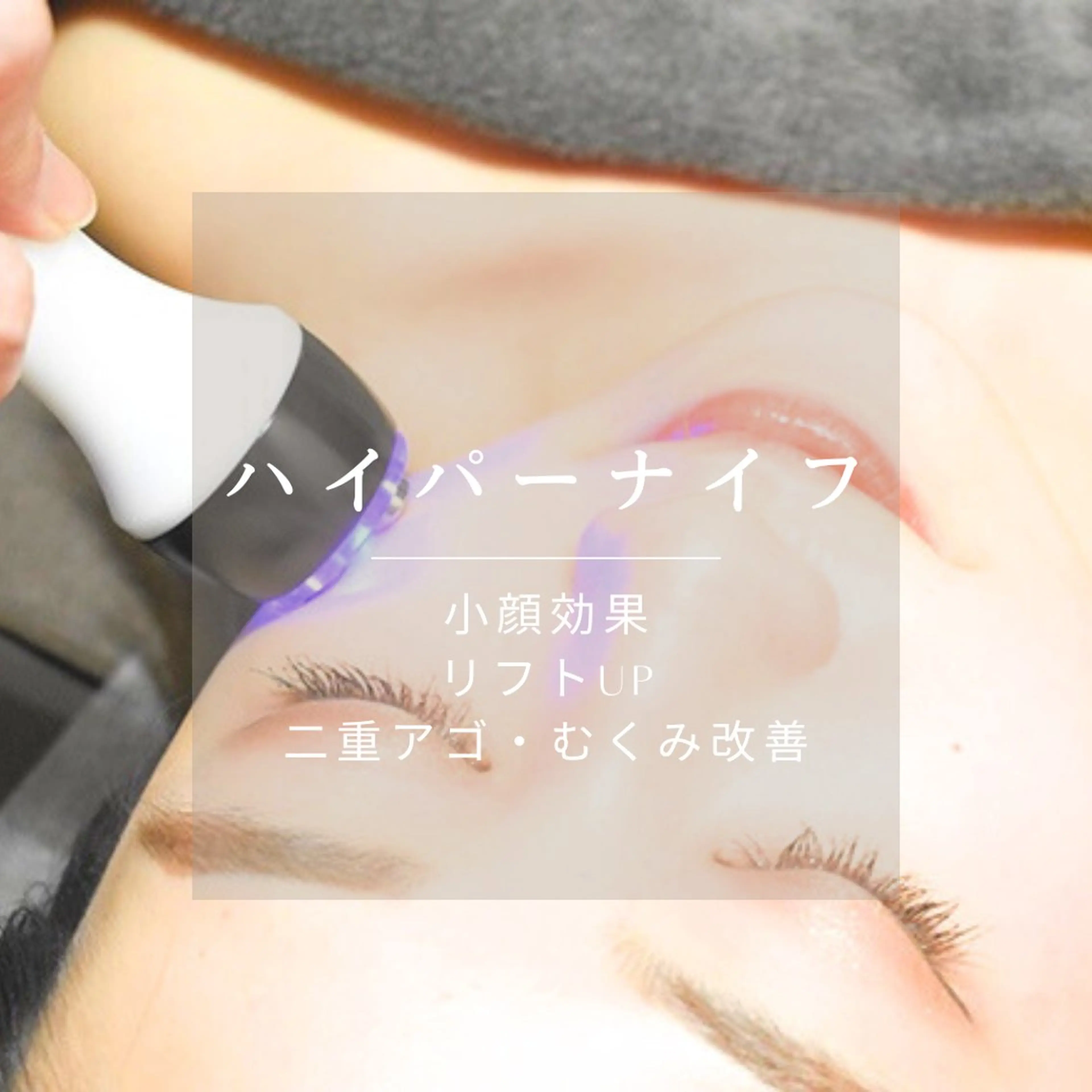 ★ミニモ学割・23歳以下限定★《瞬間小顔》【単品ハイパーナイフ】全顔+肩首デコルテリンパの写真