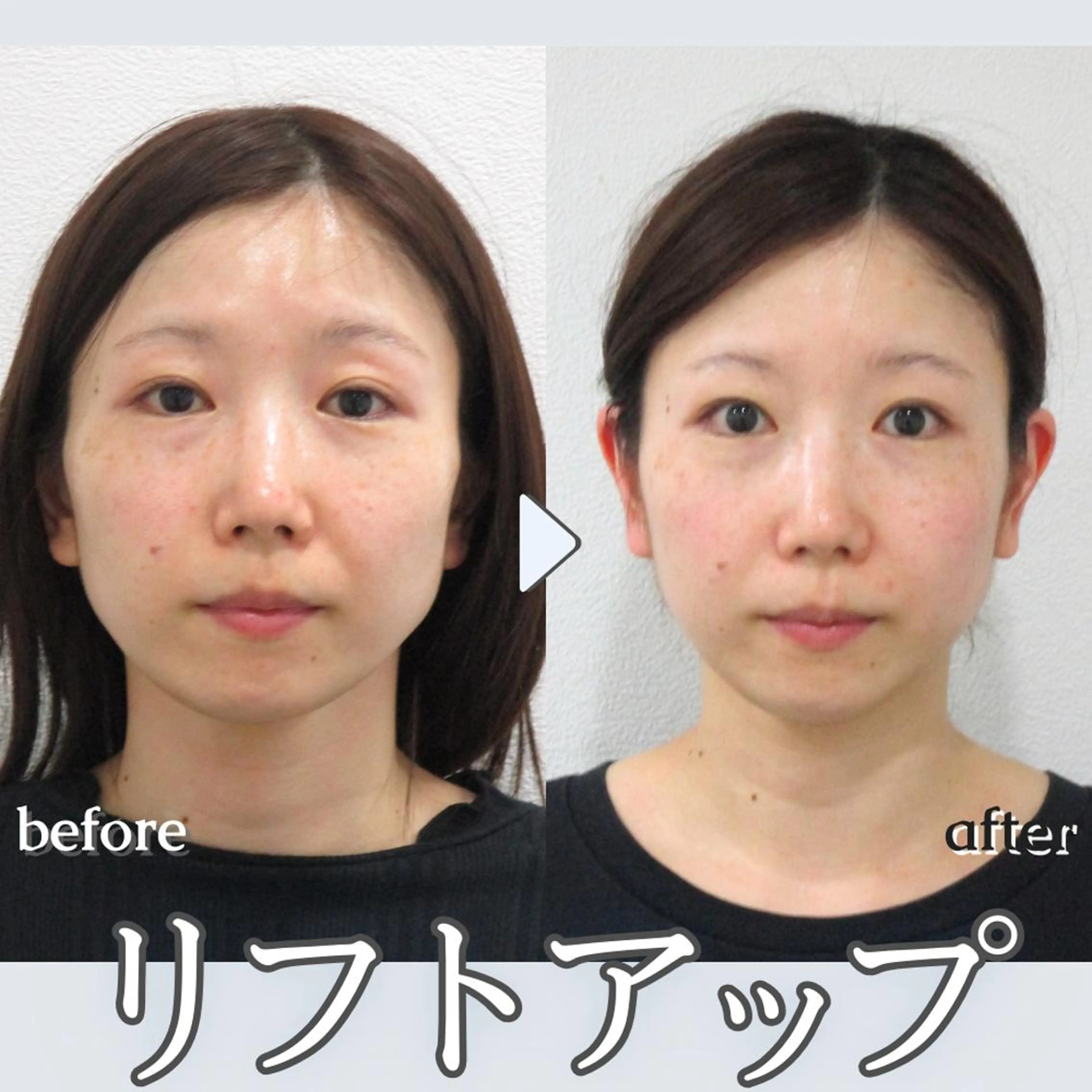 銀座美.design 栄店のエステ・リラクイメージ