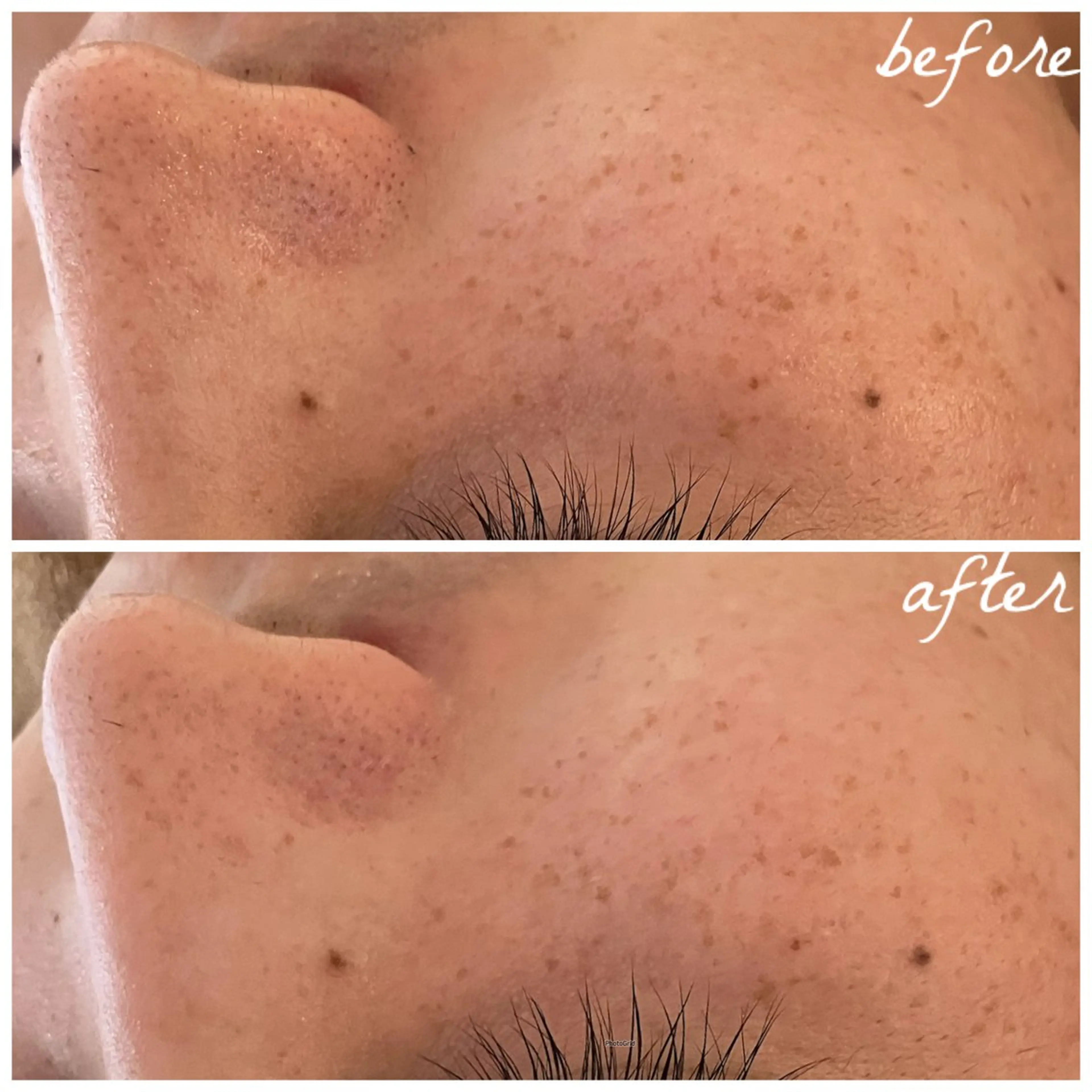 メンズ エステ メナード岐阜茜部 杉浦のエステ・リラクイメージ