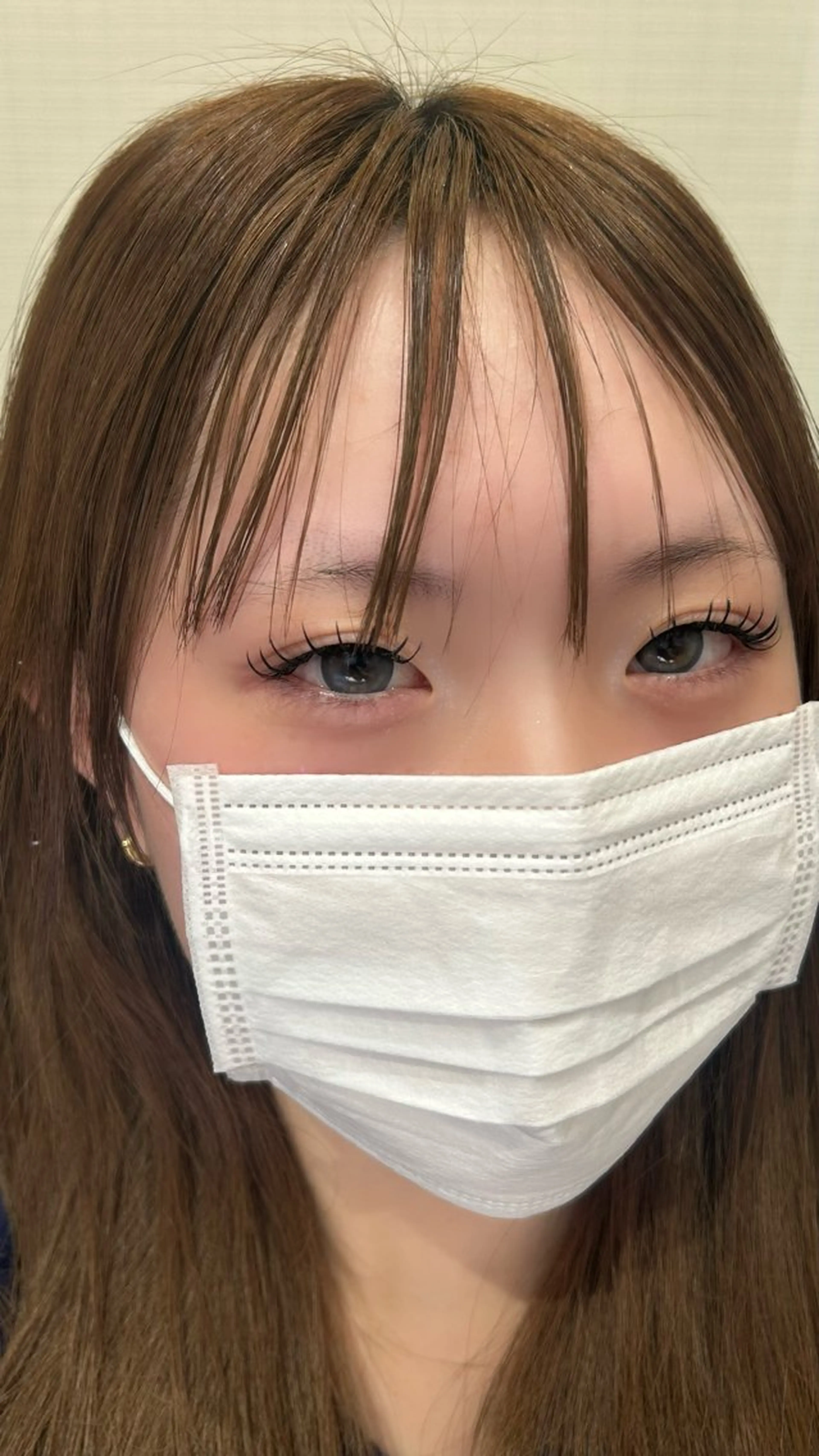 バインドロック120束の写真