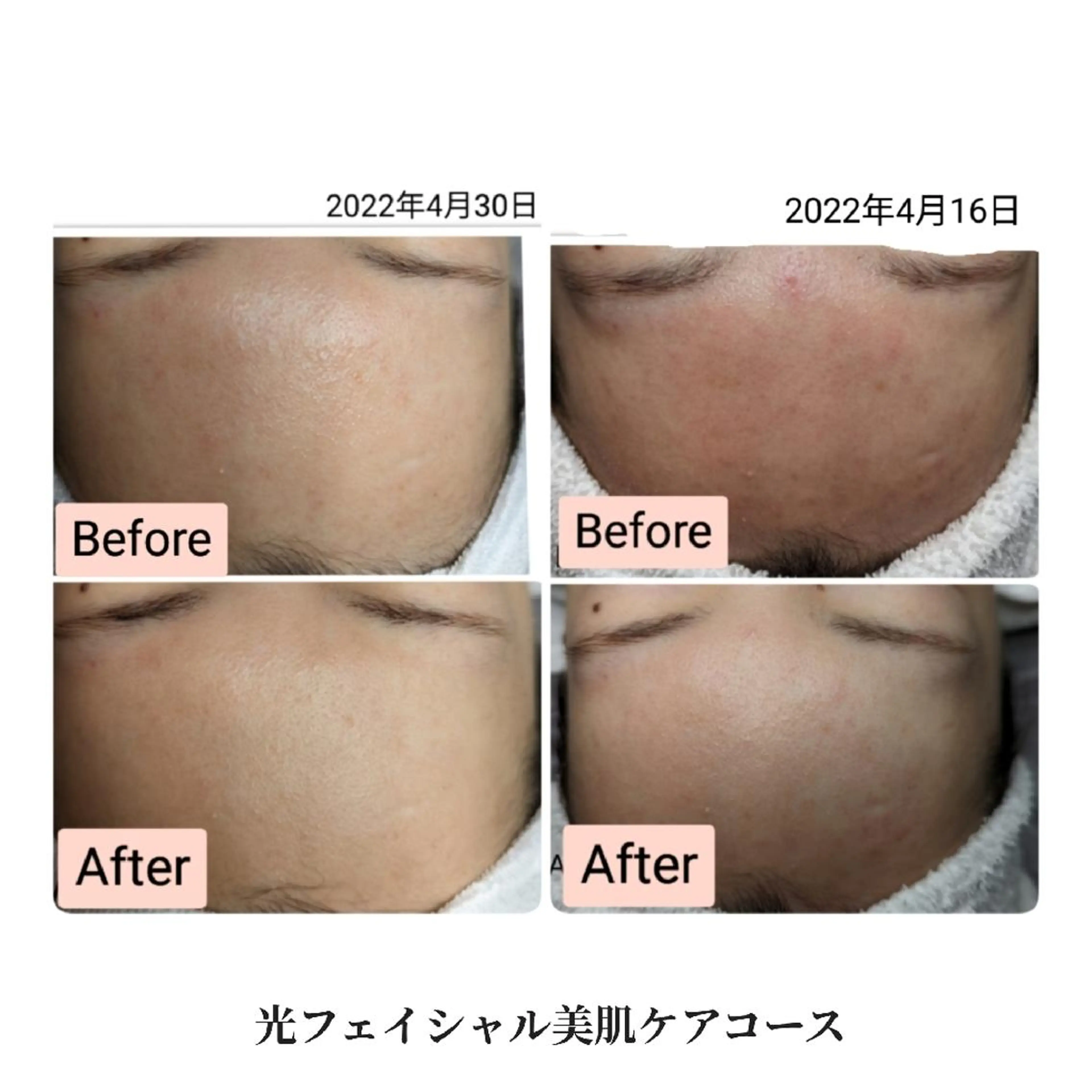 脇山 千佳のエステ・リラクイメージ