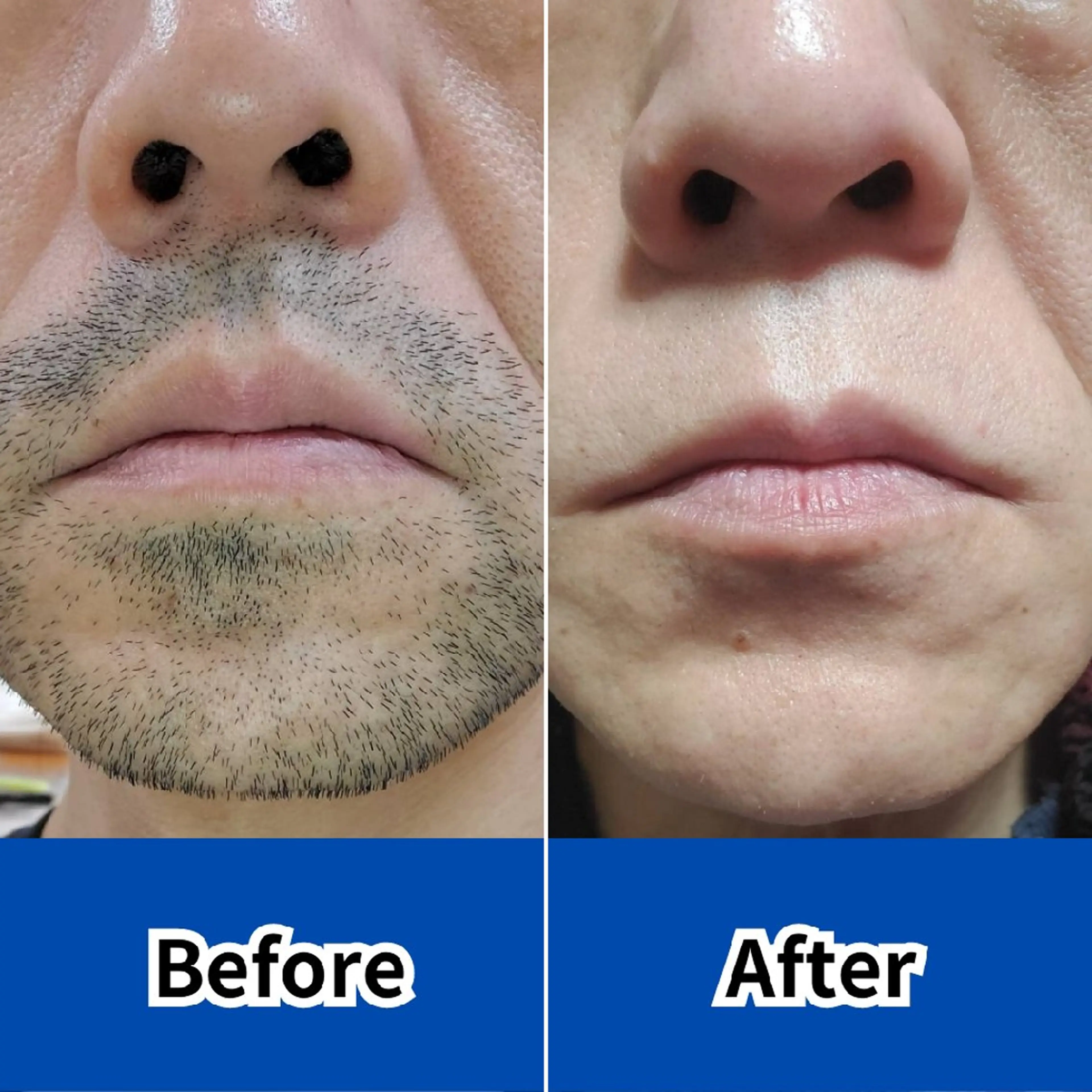 メンズ メンズ脱毛専門店Oceans所属・メンズ眉毛・脱毛専門 Oceansの眉毛・アイブロウイメージ