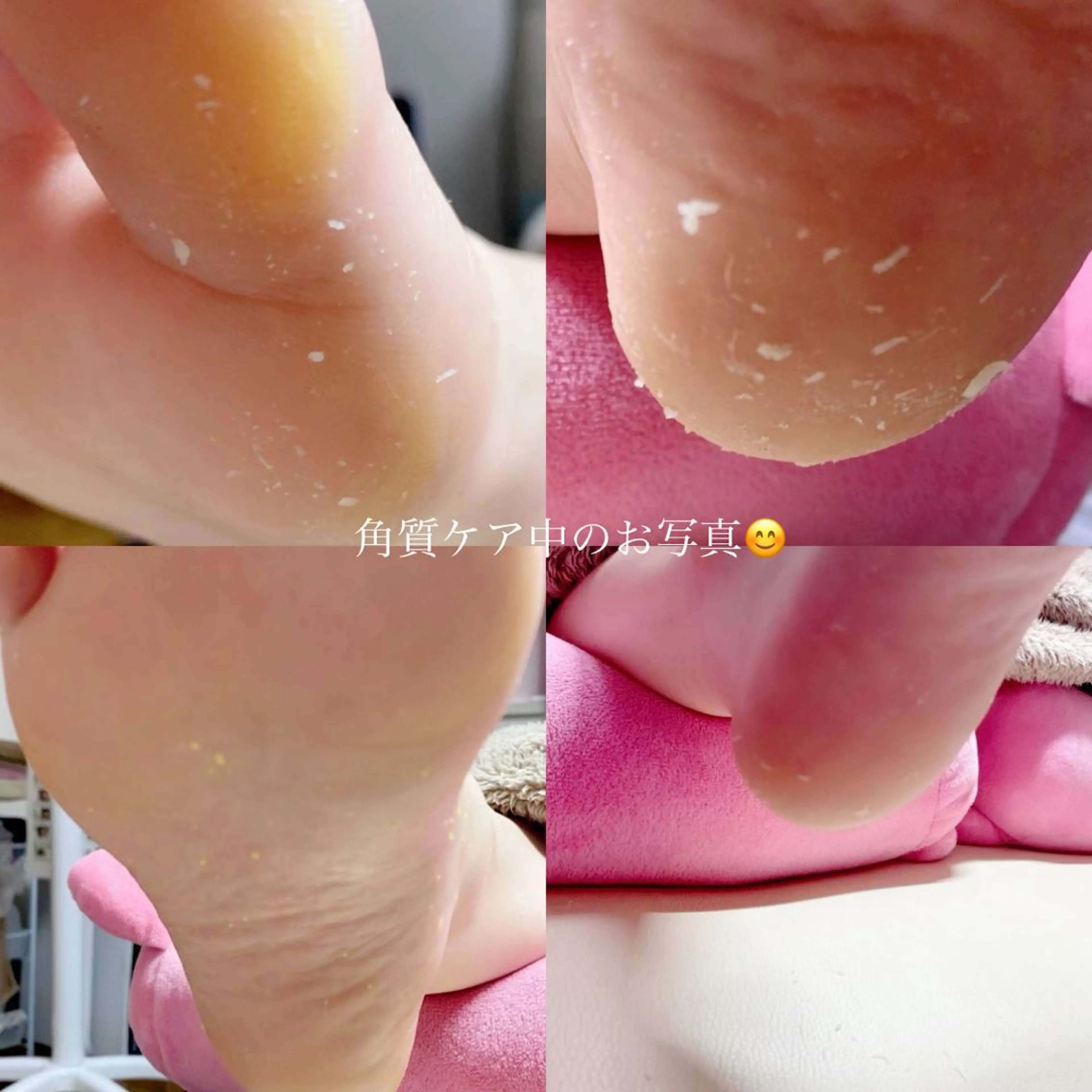 ネイル ネイル/耳つぼ /新ホワイトニングのネイルデザイン