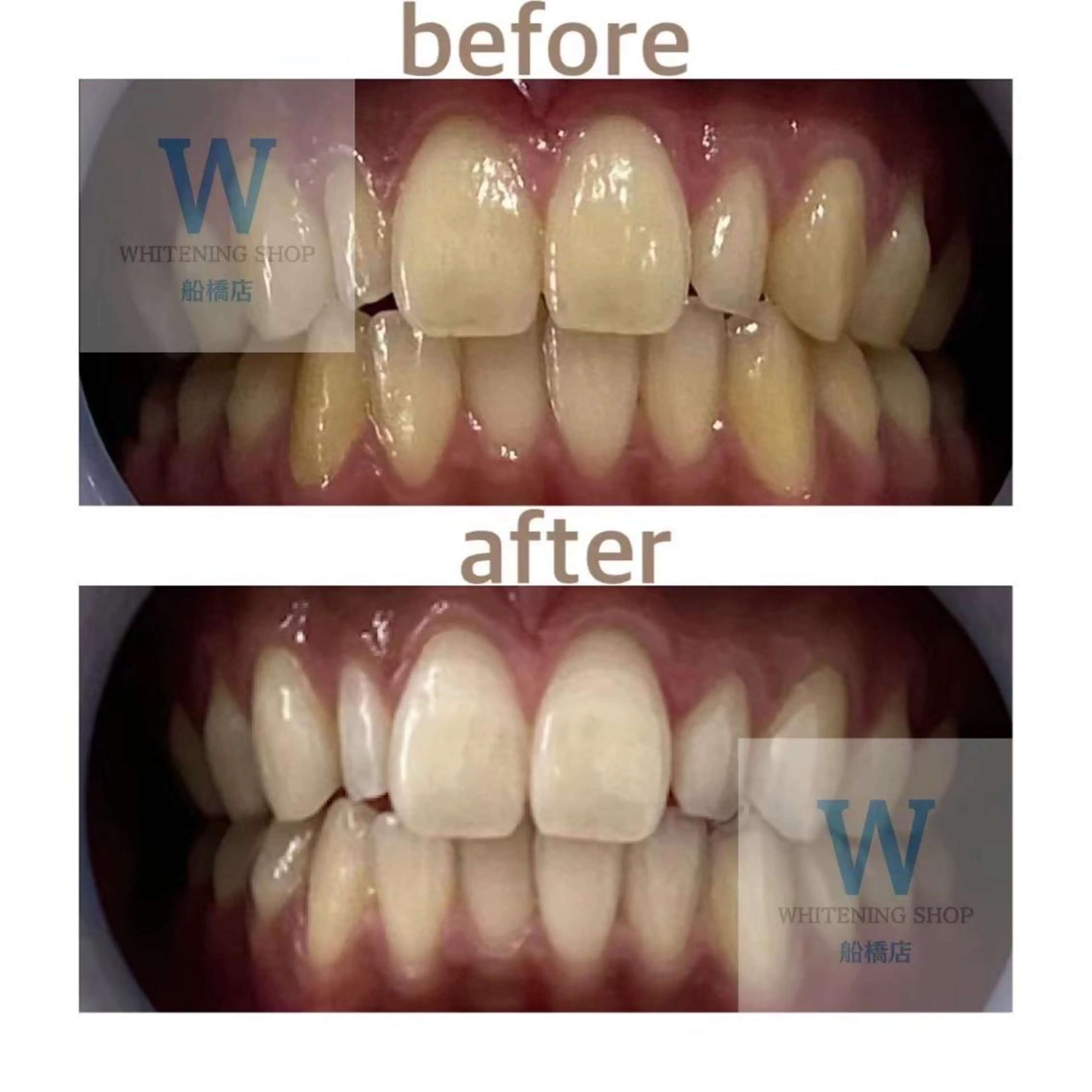 ホワイトニング ショップ船橋2号店のエステ・リラクイメージ