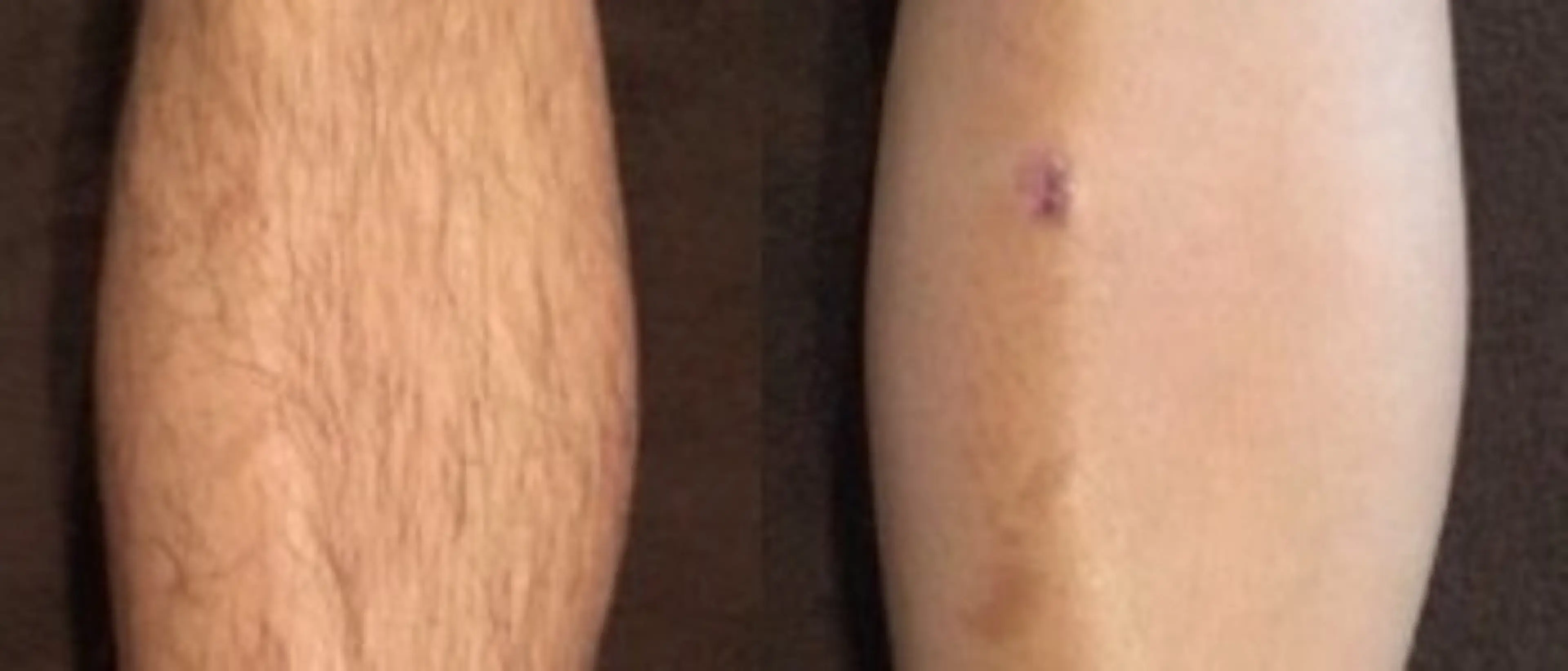 脱毛 YES脱毛サロン　大阪京橋店所属・メンズ脱毛サロン YESのエステ・リラクイメージ