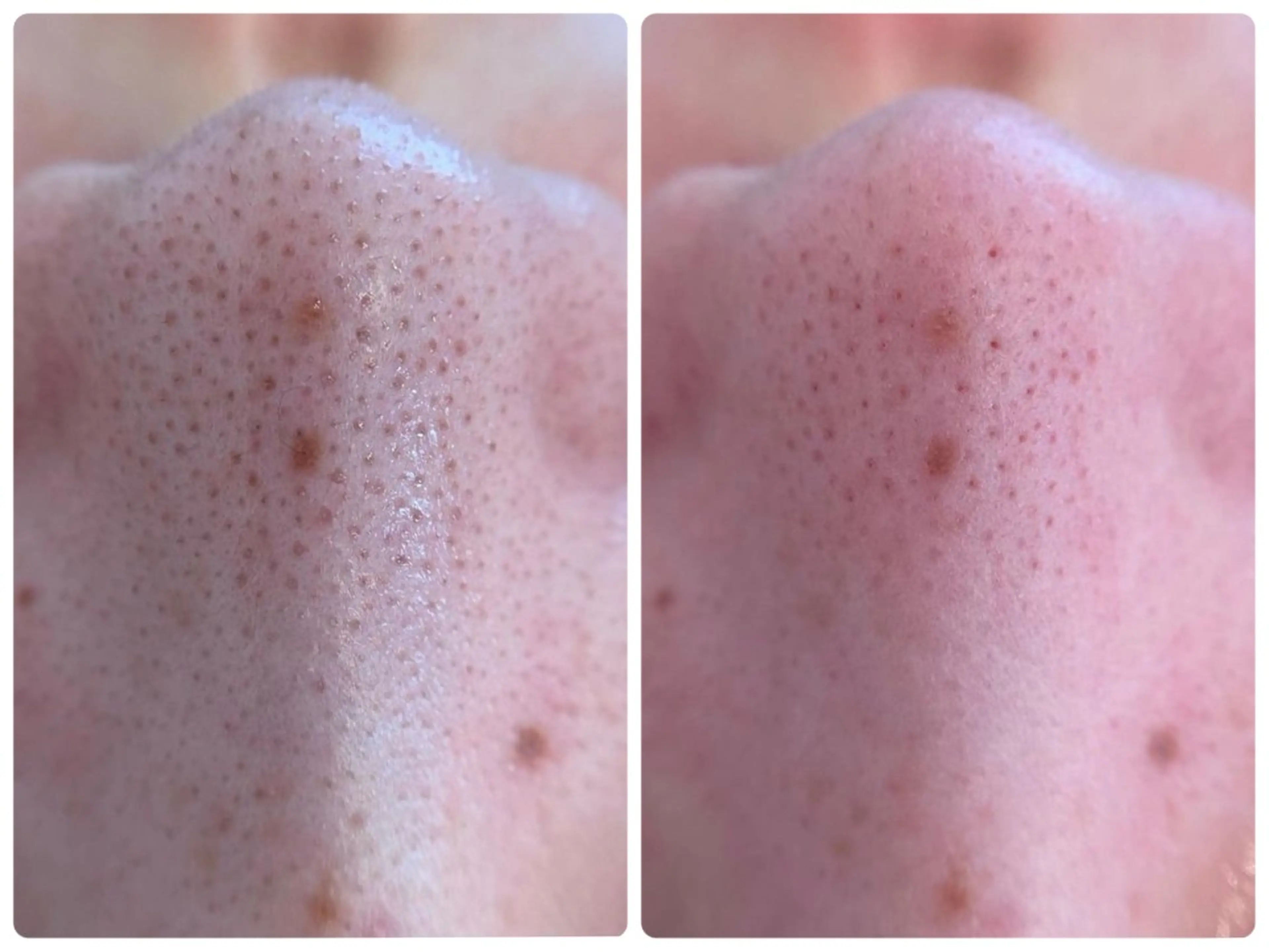 エステ Hisui 小出のエステ・リラクイメージ