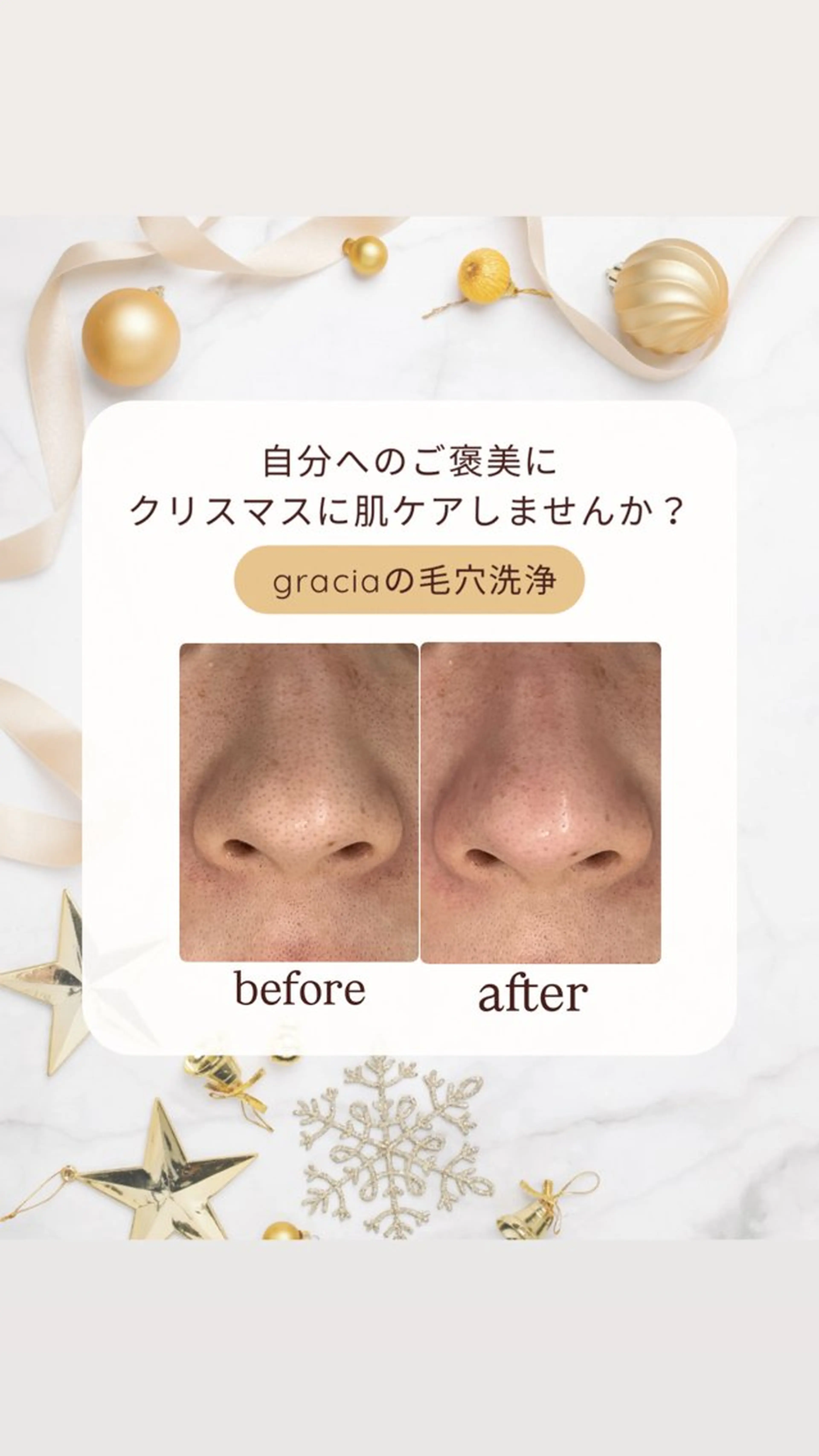 エステ 上西 こころのエステ・リラクイメージ