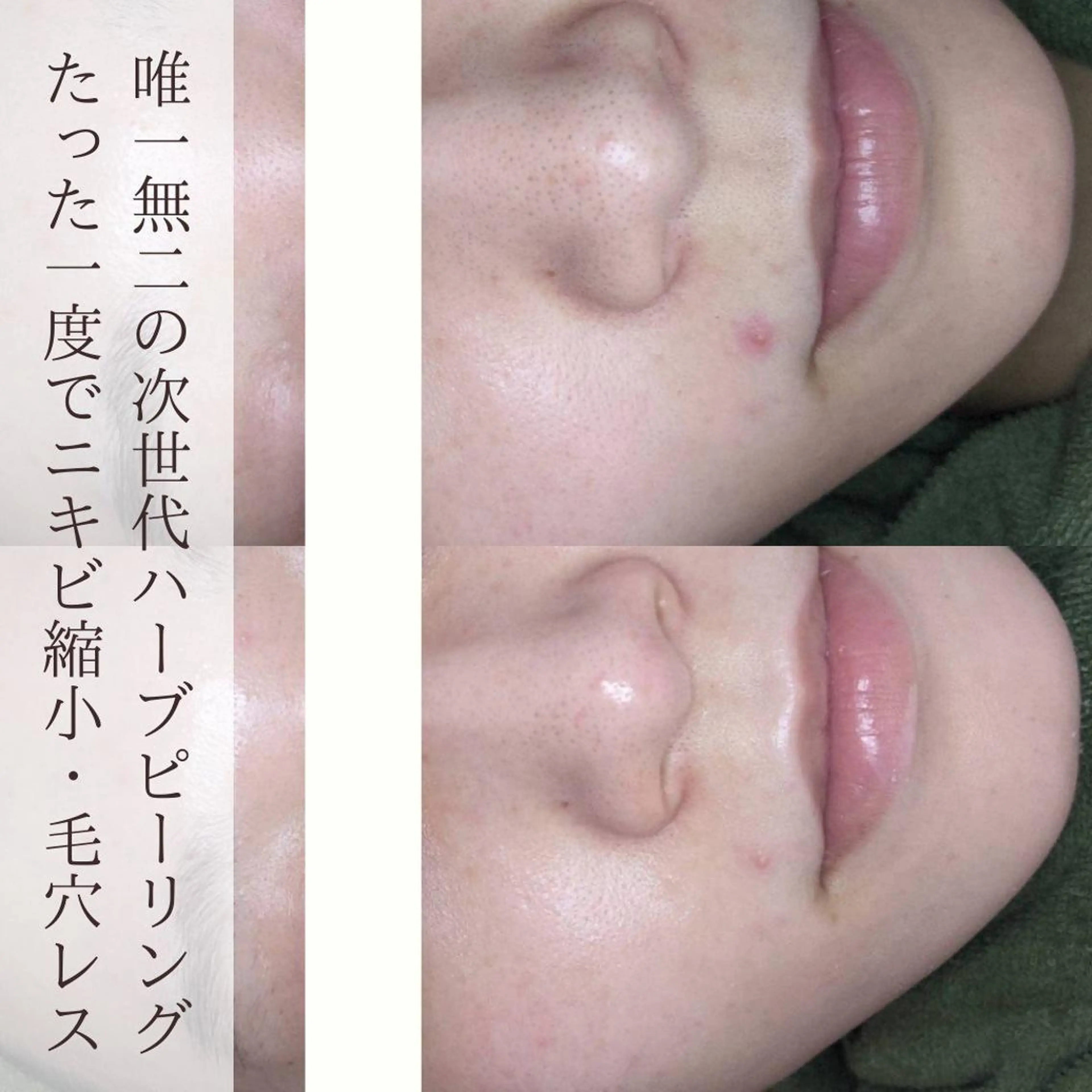 エステ emirai 🌙AYANOのエステ・リラクイメージ