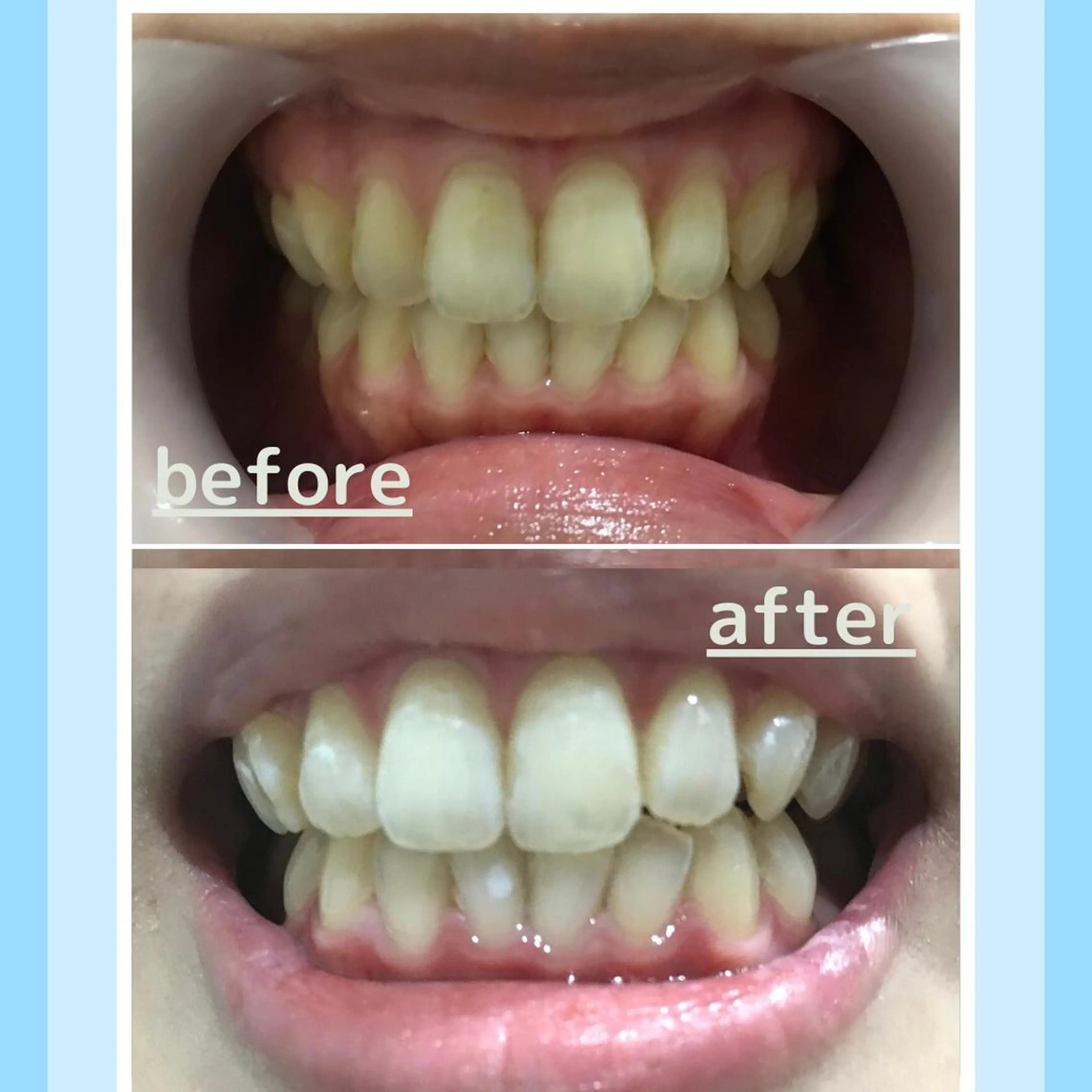 メンズ お手軽ホワイトニングsalon mina所属・武元 奈津美のその他イメージ