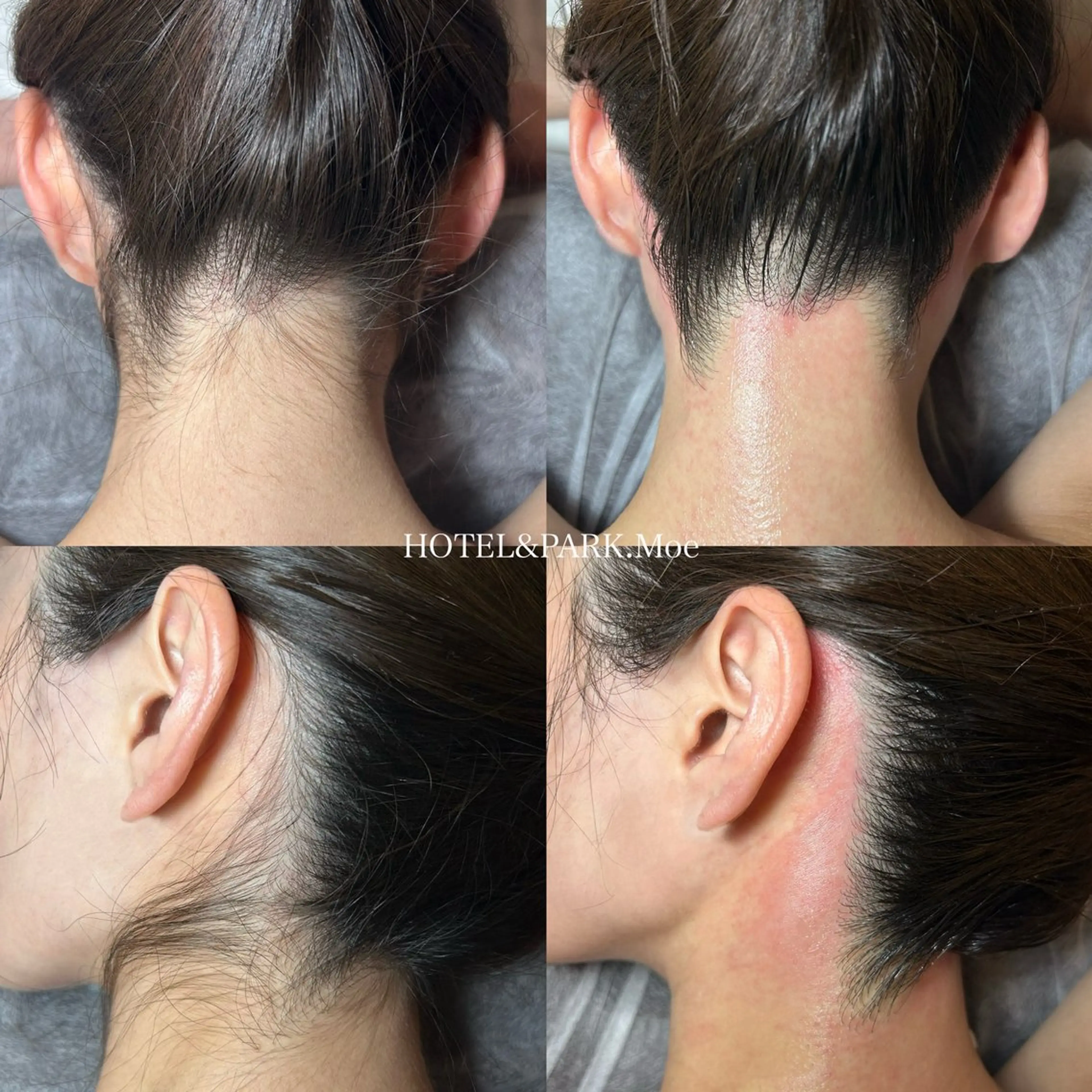 脱毛 HOTEL&PARK .Moeワックス脱毛のエステ・リラクイメージ