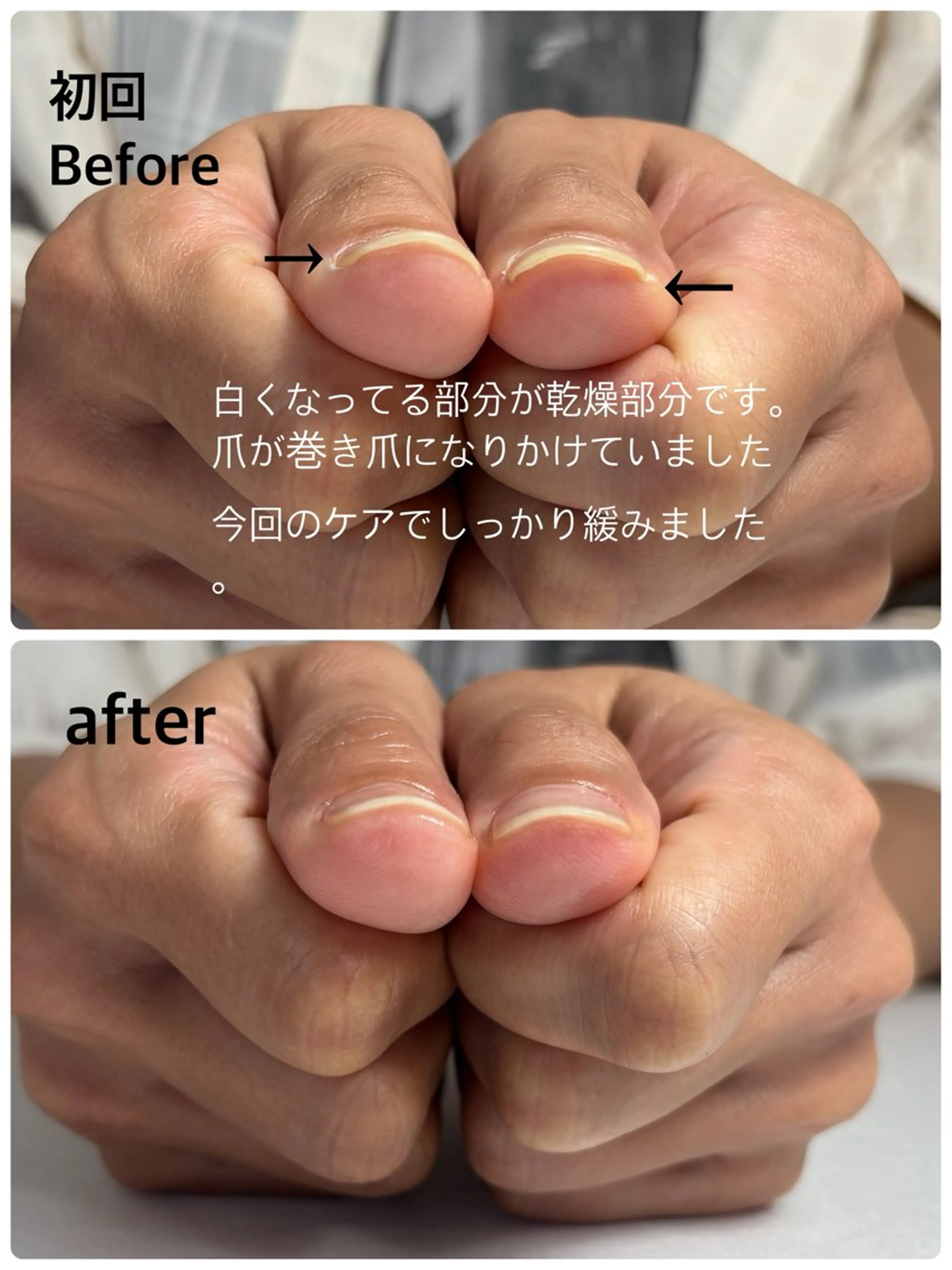 ネイル Alo.nail アロ•ネイルのネイルデザイン