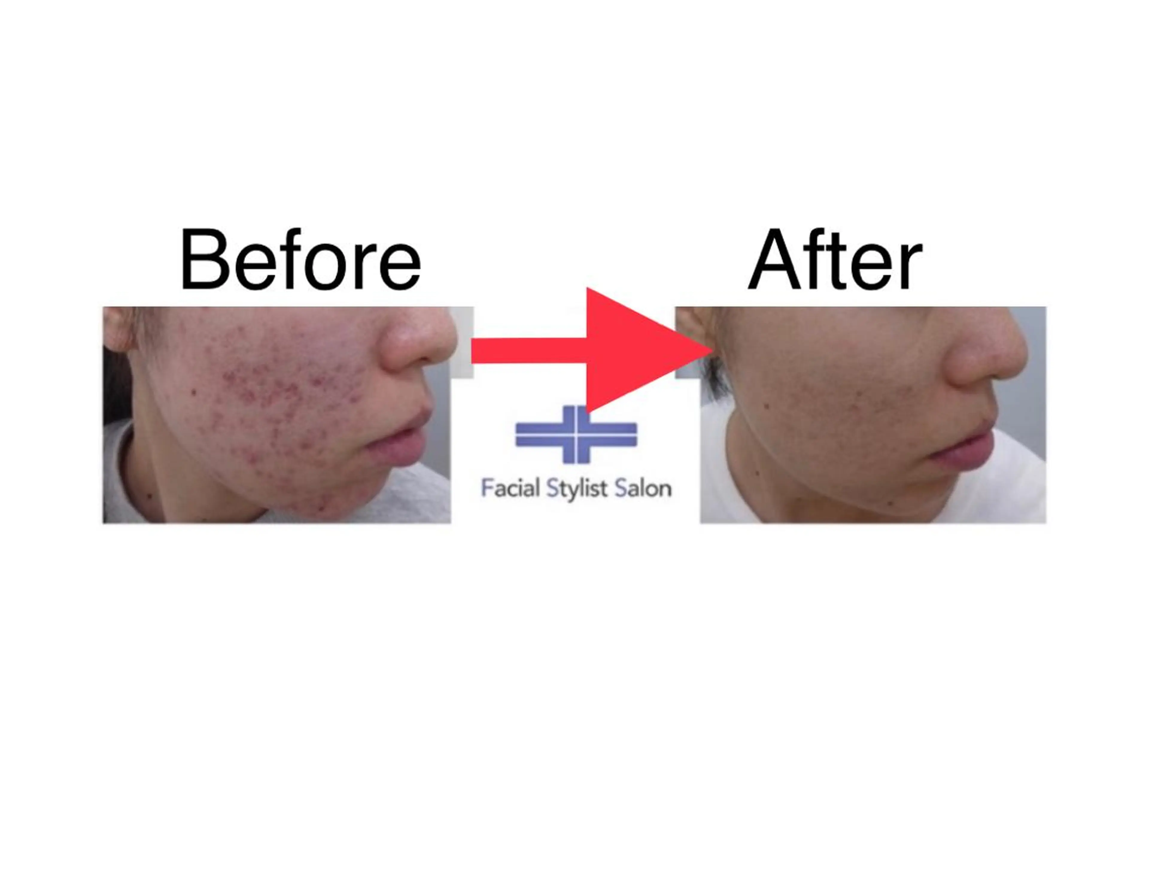 メンズ 肌質改善専門 鈴木悠のエステ・リラクイメージ