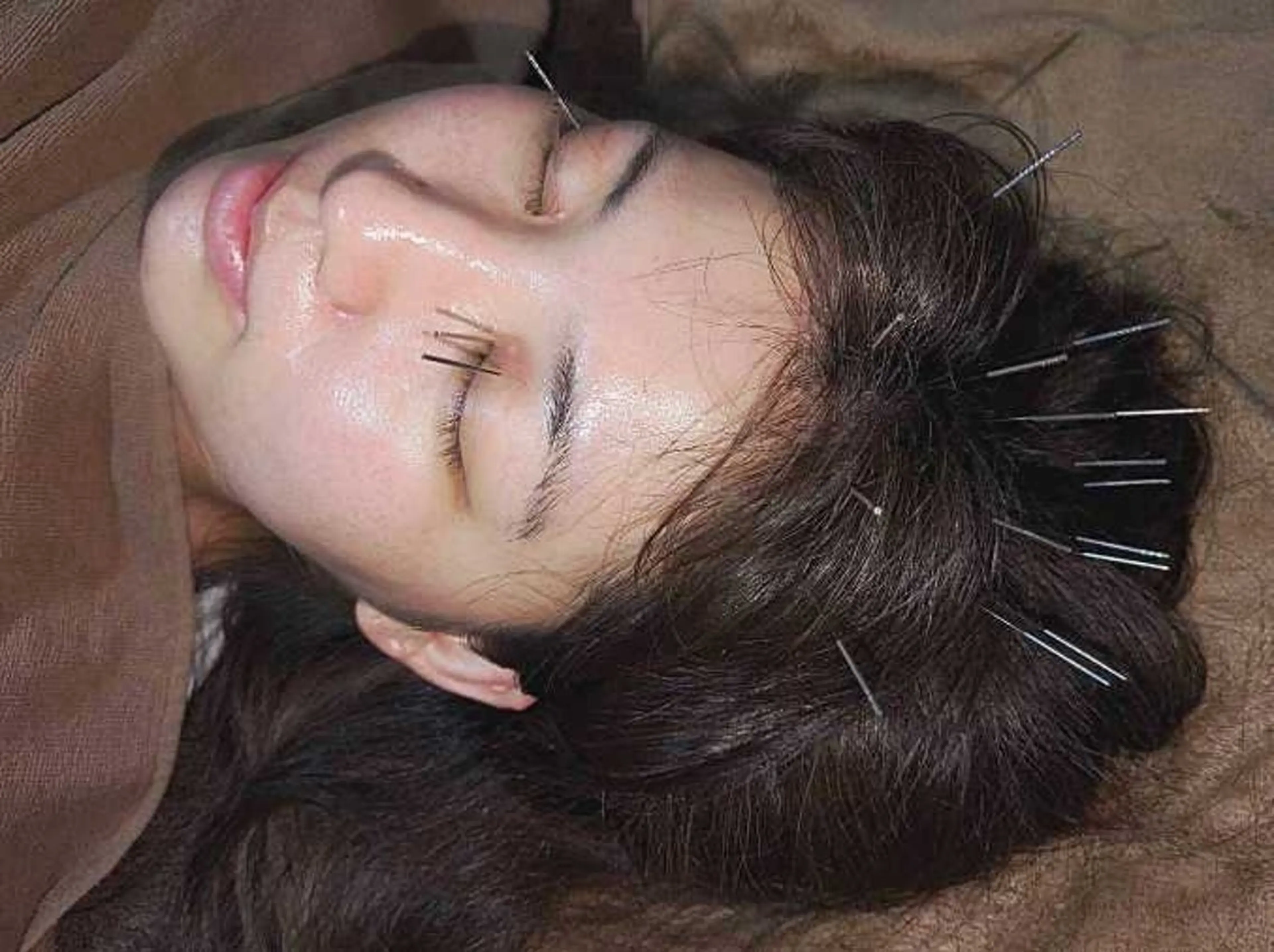 【口コミ・モニター限定】脳ストレス・眼精疲労・頭痛スッキリ鍼灸メニューの写真