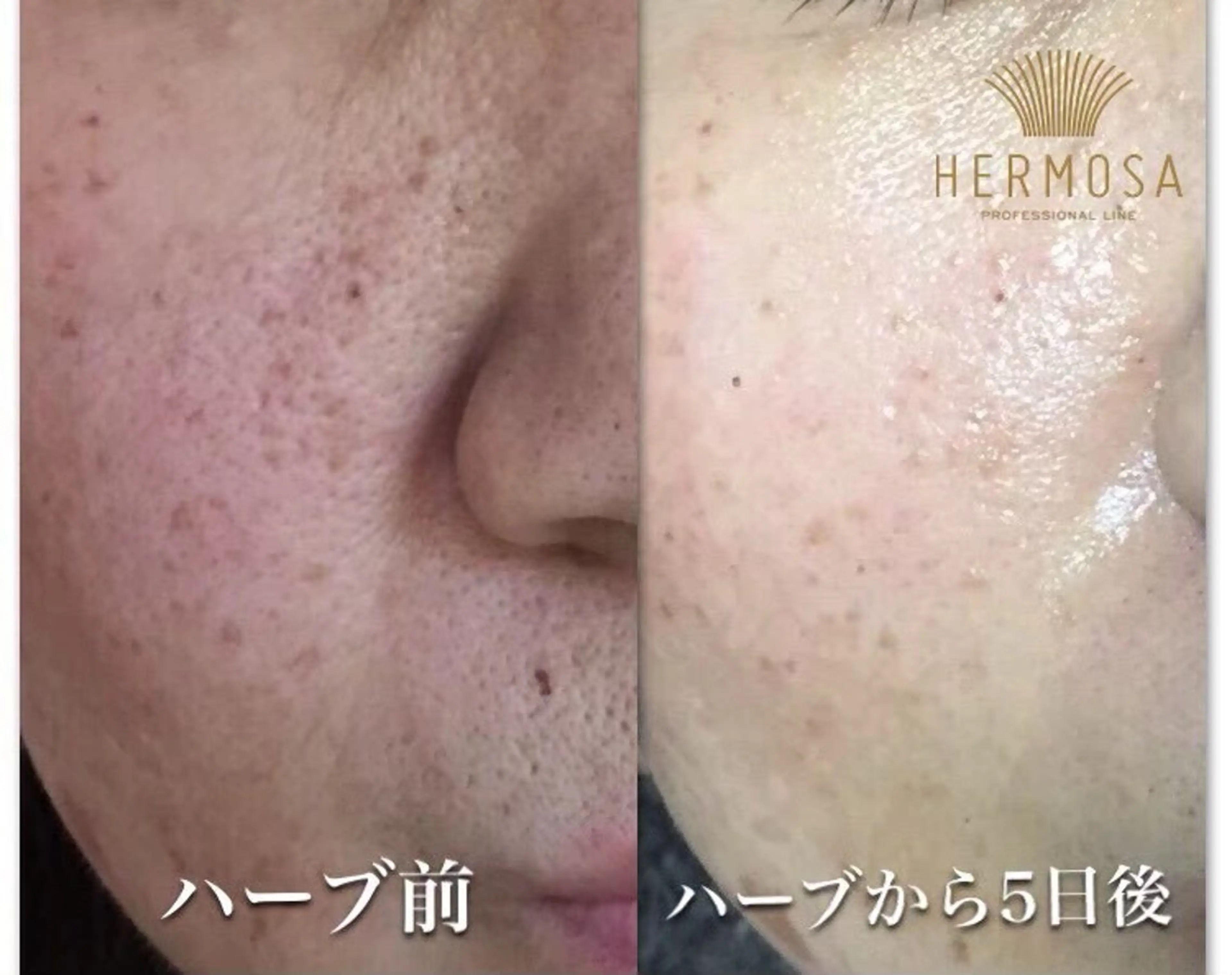 オールハンド フェイシャルのエステ・リラクイメージ