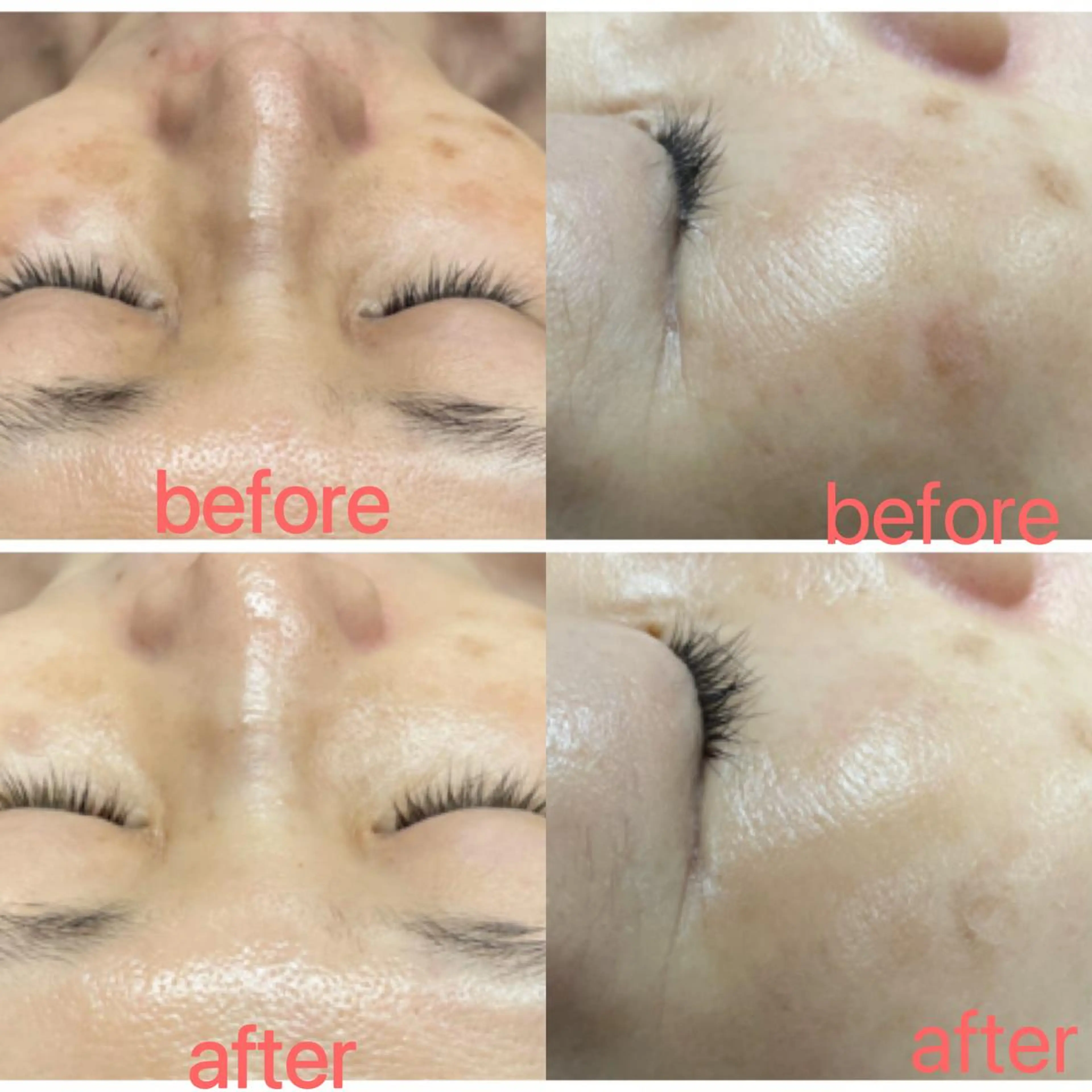 💎史上最高美肌💎陶肌トリートメント(陶肌パウダー2g)＋オプション1つプレゼント🎁✨(生酵素)の写真