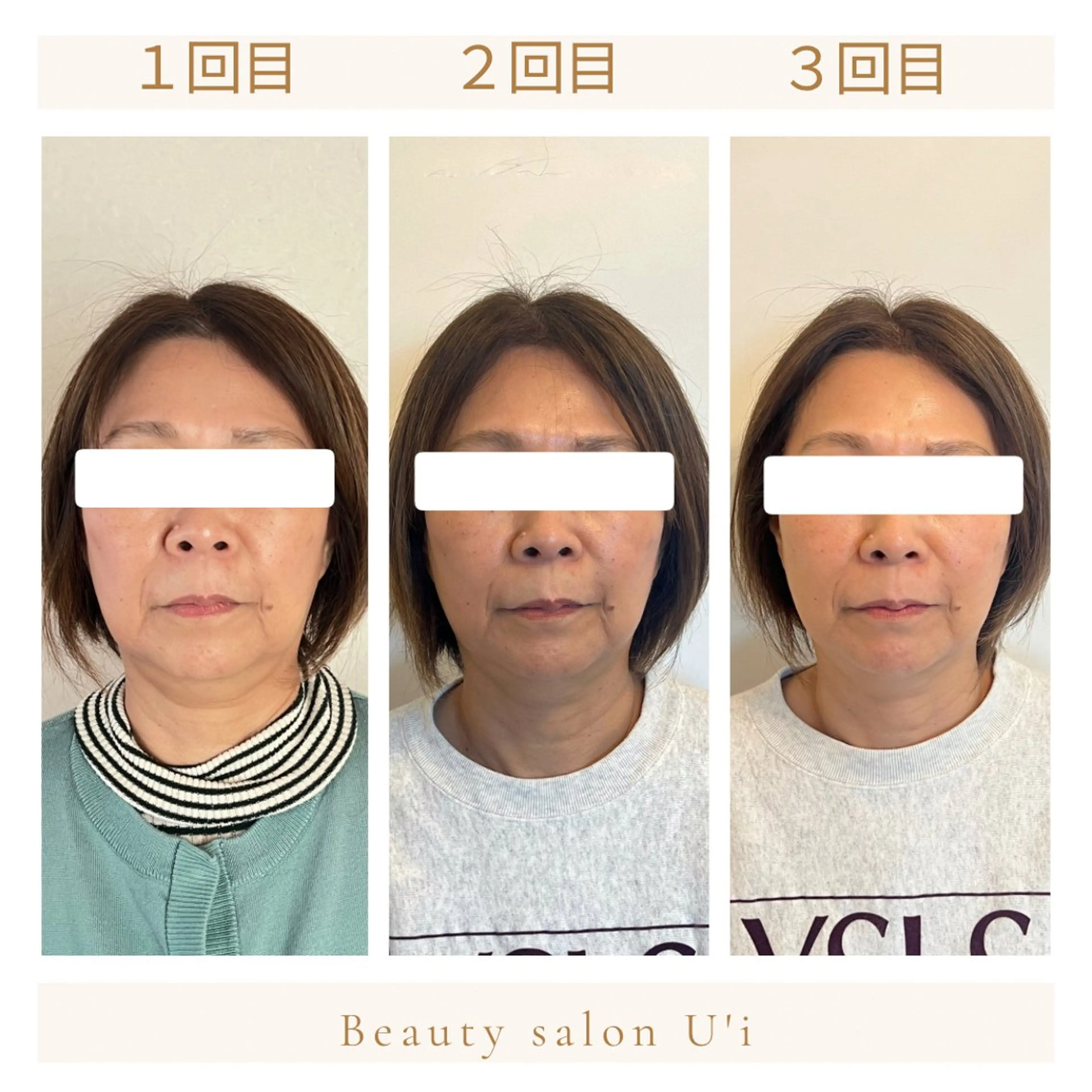 エステ リラク 頭蓋骨小顔矯正 藤本のエステ・リラクイメージ