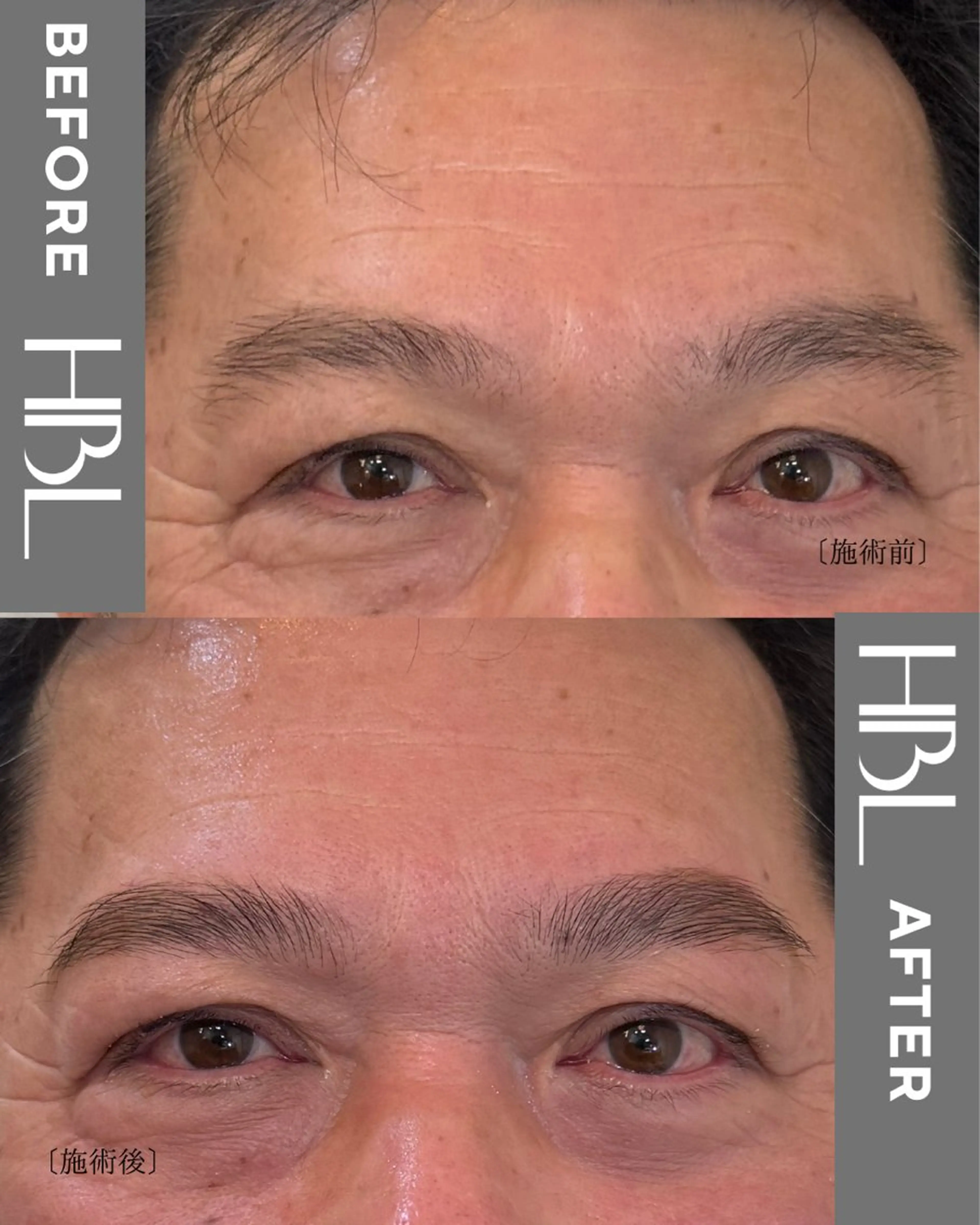 アイブロウ ワックス脱毛 その他(アイブロウ) élan所属・élan MIKAのネイルデザイン