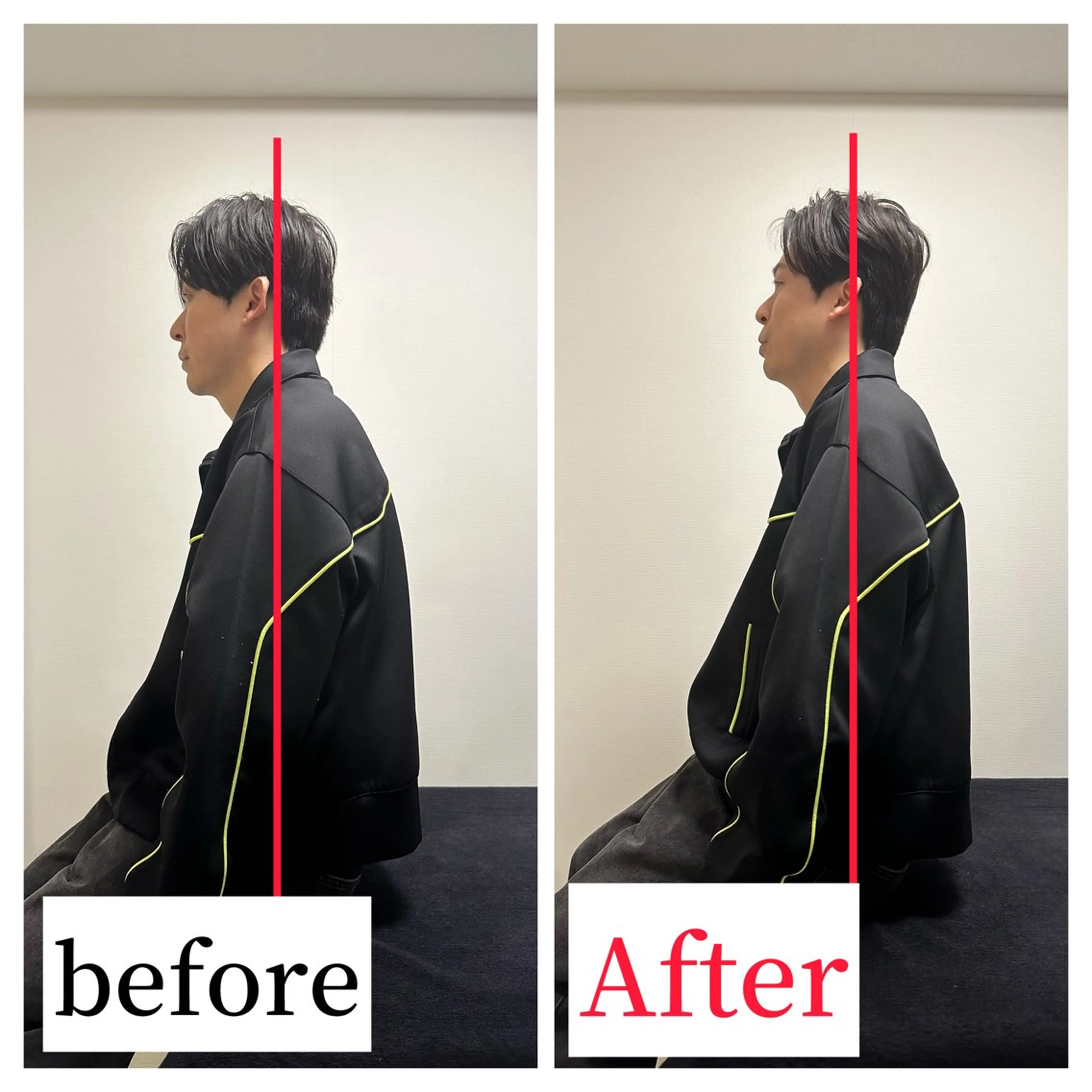 【⚠️2回目以降限定】⭐️リピート数No.1⭐️【猫背/巻き肩🐱】デスクワークでの体の歪み改善🌈主婦様にも大人気‼️の写真